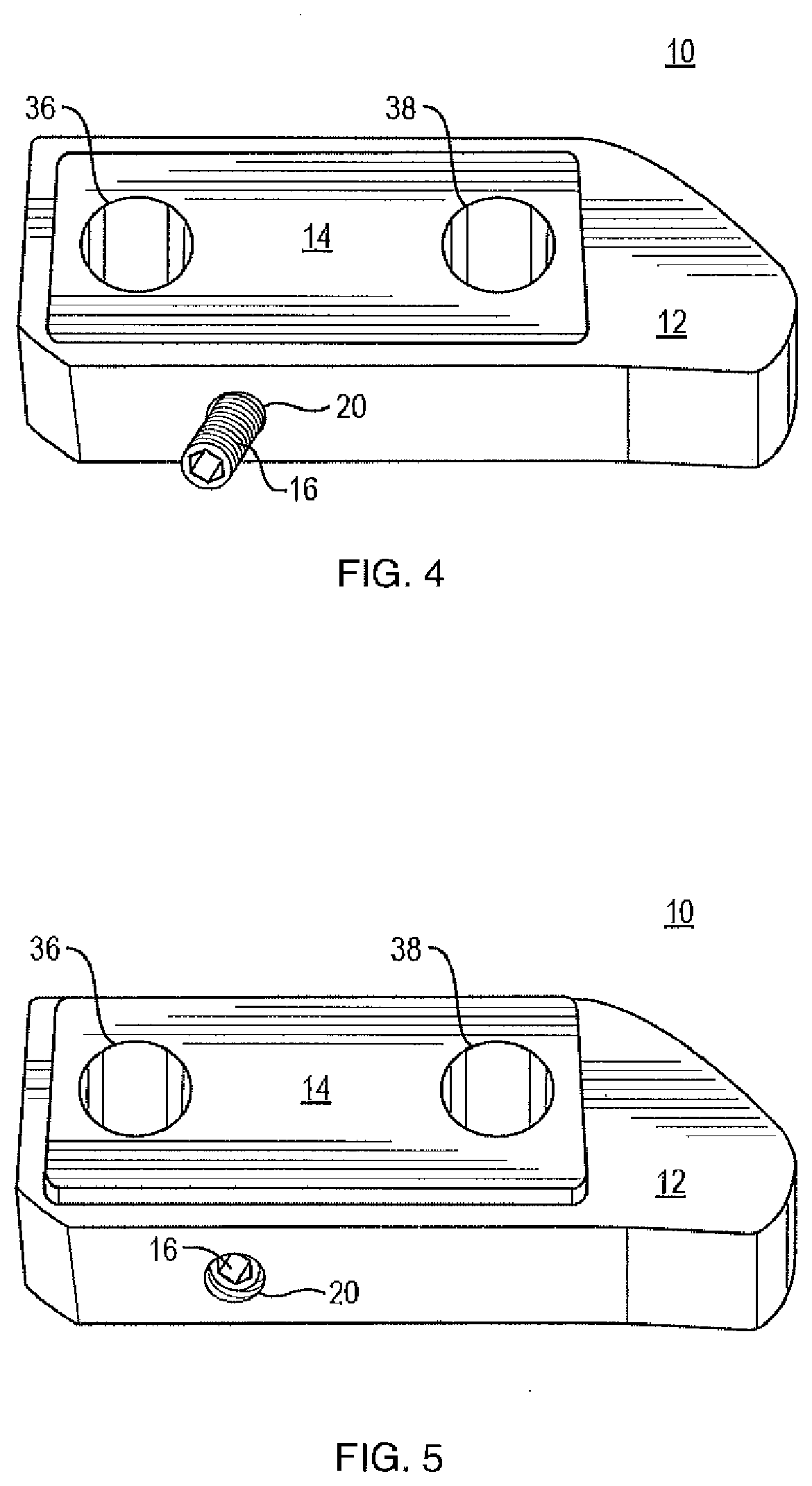 Patent US12472074 Figure 4 – Expandable spinal implant apparatus and method of use