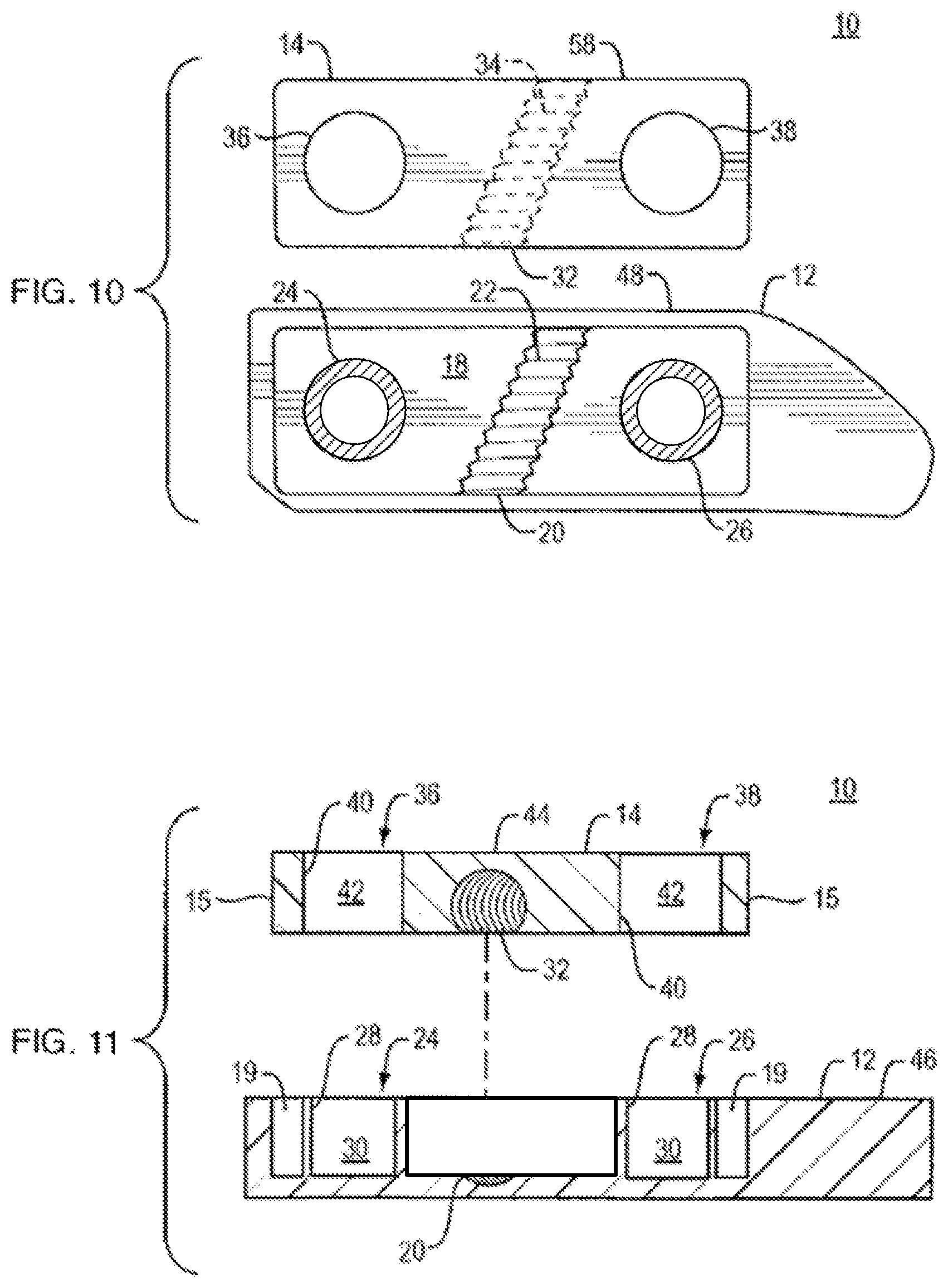 Patent US12472074 Figure 6 – Expandable spinal implant apparatus and method of use