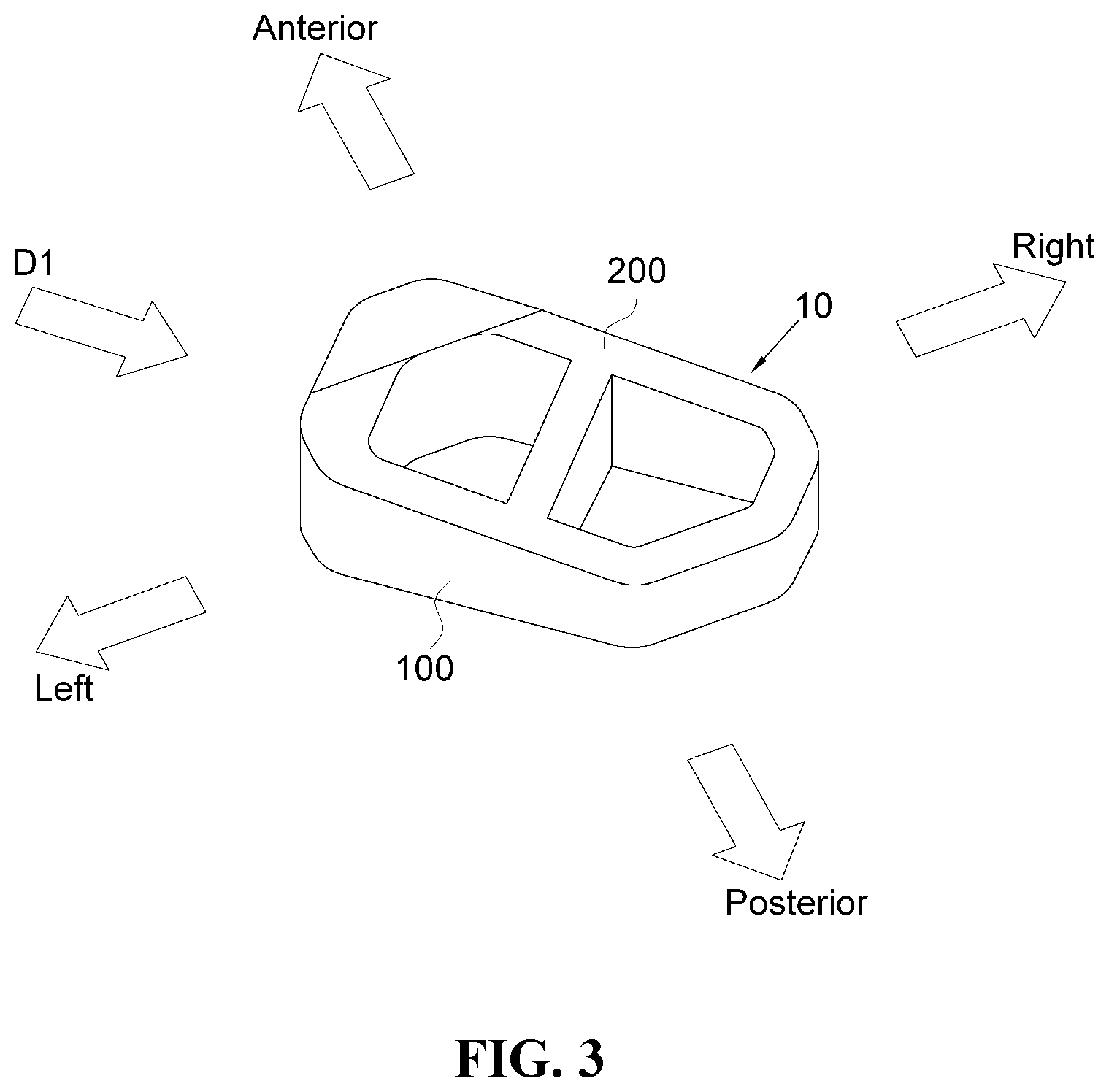 Patent US12472076 Figure 3 – Oblique lateral insertion-type intervertebral cage
