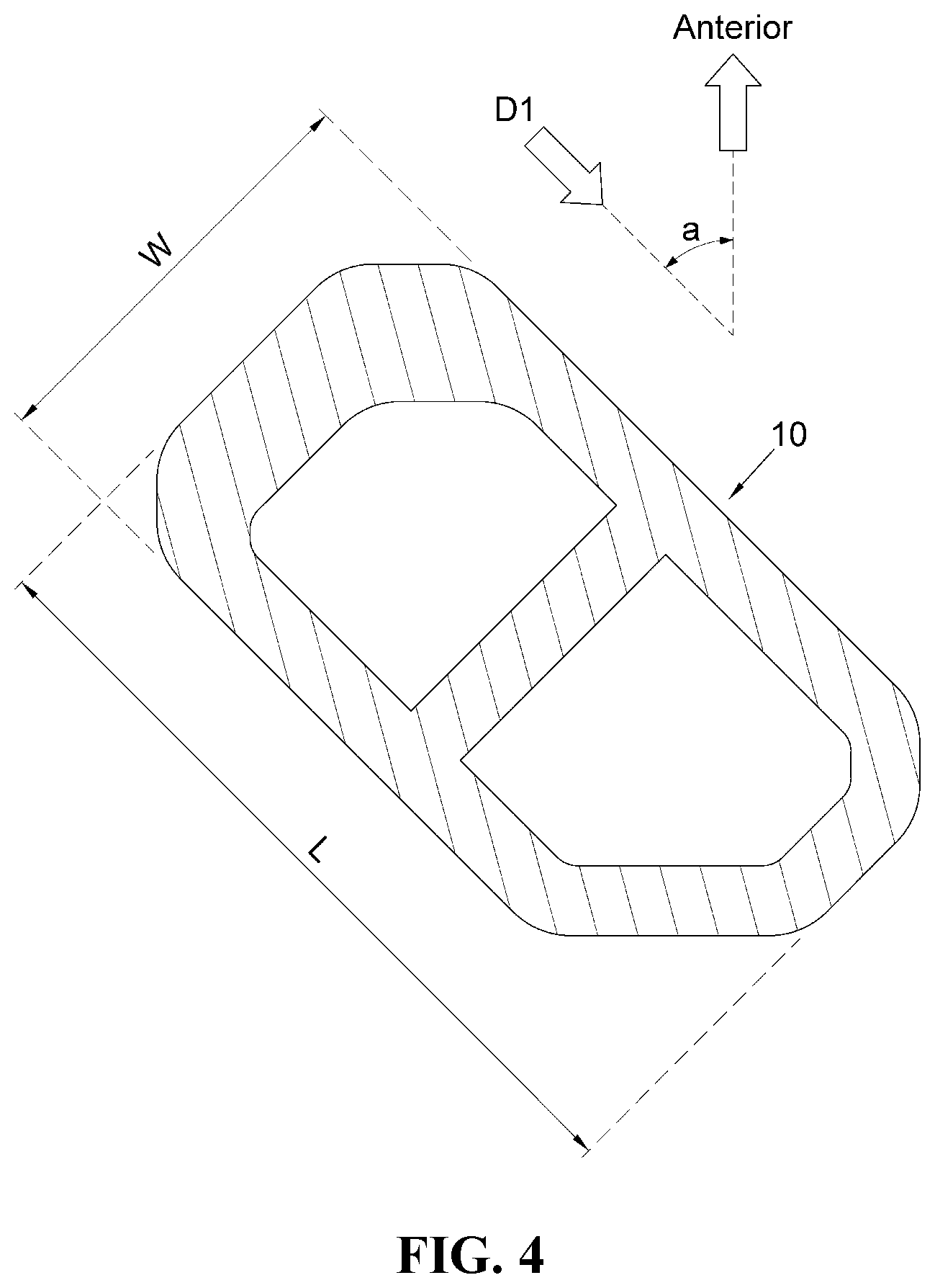 Patent US12472076 Figure 4 – Oblique lateral insertion-type intervertebral cage