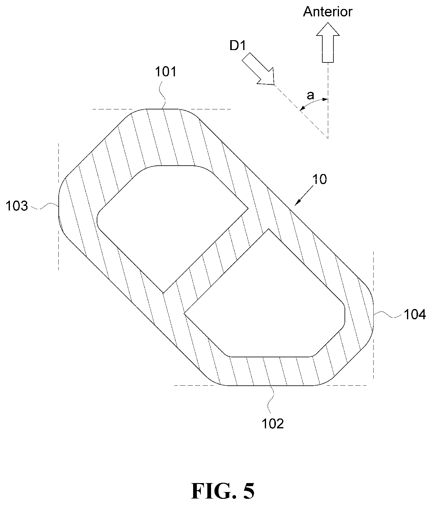 Patent US12472076 Figure 5 – Oblique lateral insertion-type intervertebral cage