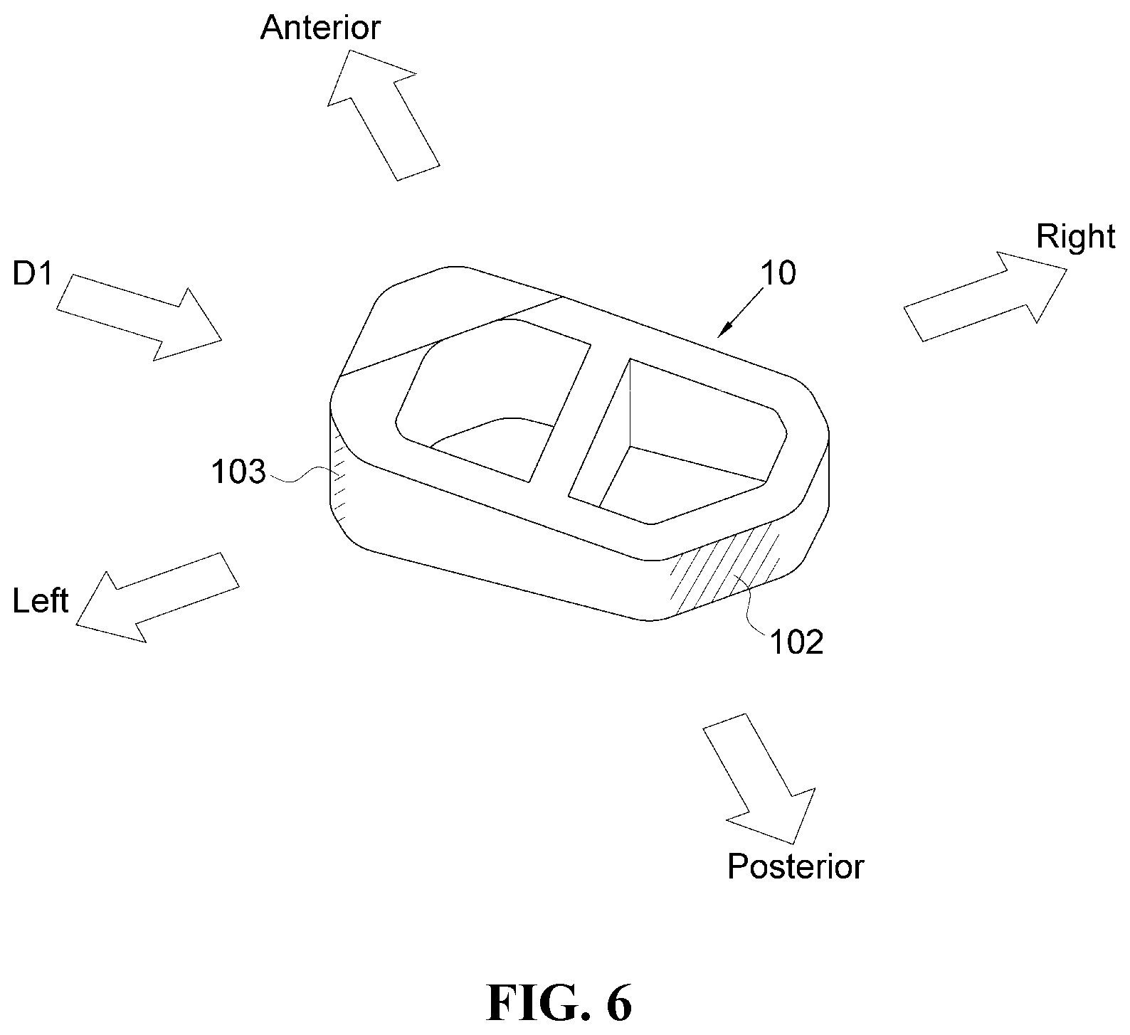 Patent US12472076 Figure 6 – Oblique lateral insertion-type intervertebral cage