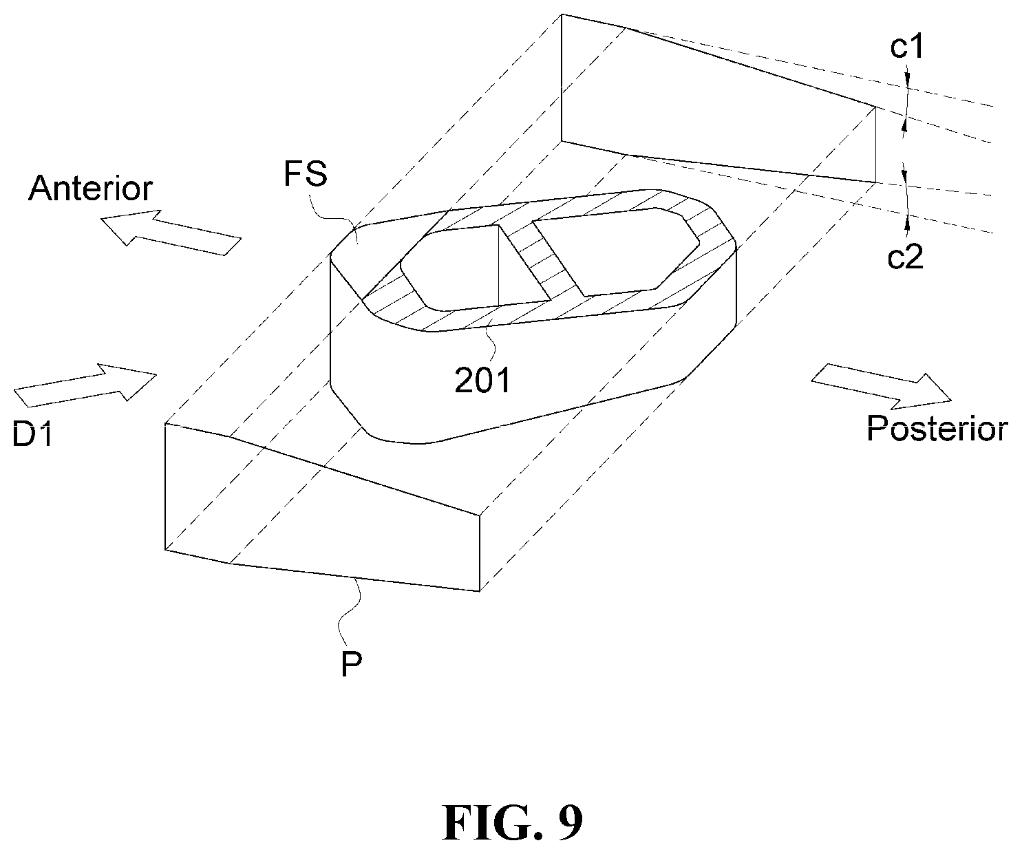 Patent US12472076 Figure 9 – Oblique lateral insertion-type intervertebral cage