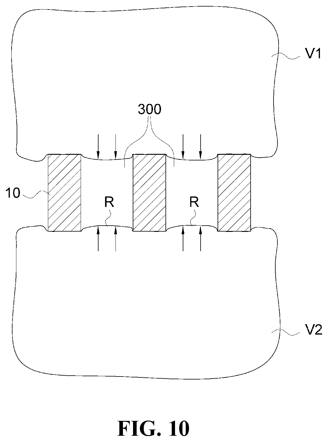 Patent US12472076 Figure 10 – Oblique lateral insertion-type intervertebral cage