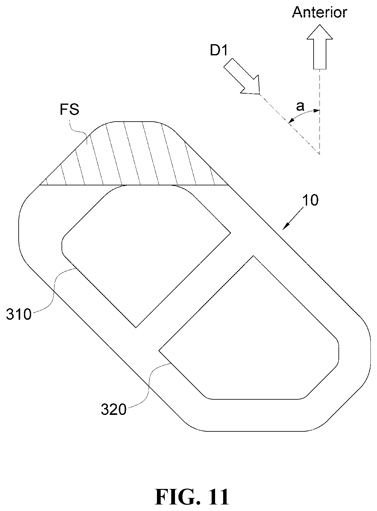 Patent US12472076 Figure 11 – Oblique lateral insertion-type intervertebral cage