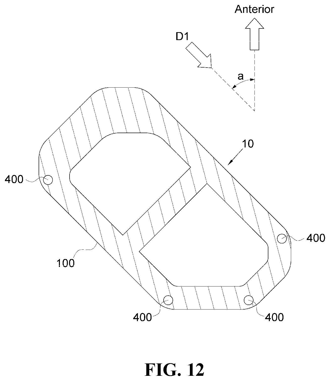 Patent US12472076 Figure 12 – Oblique lateral insertion-type intervertebral cage