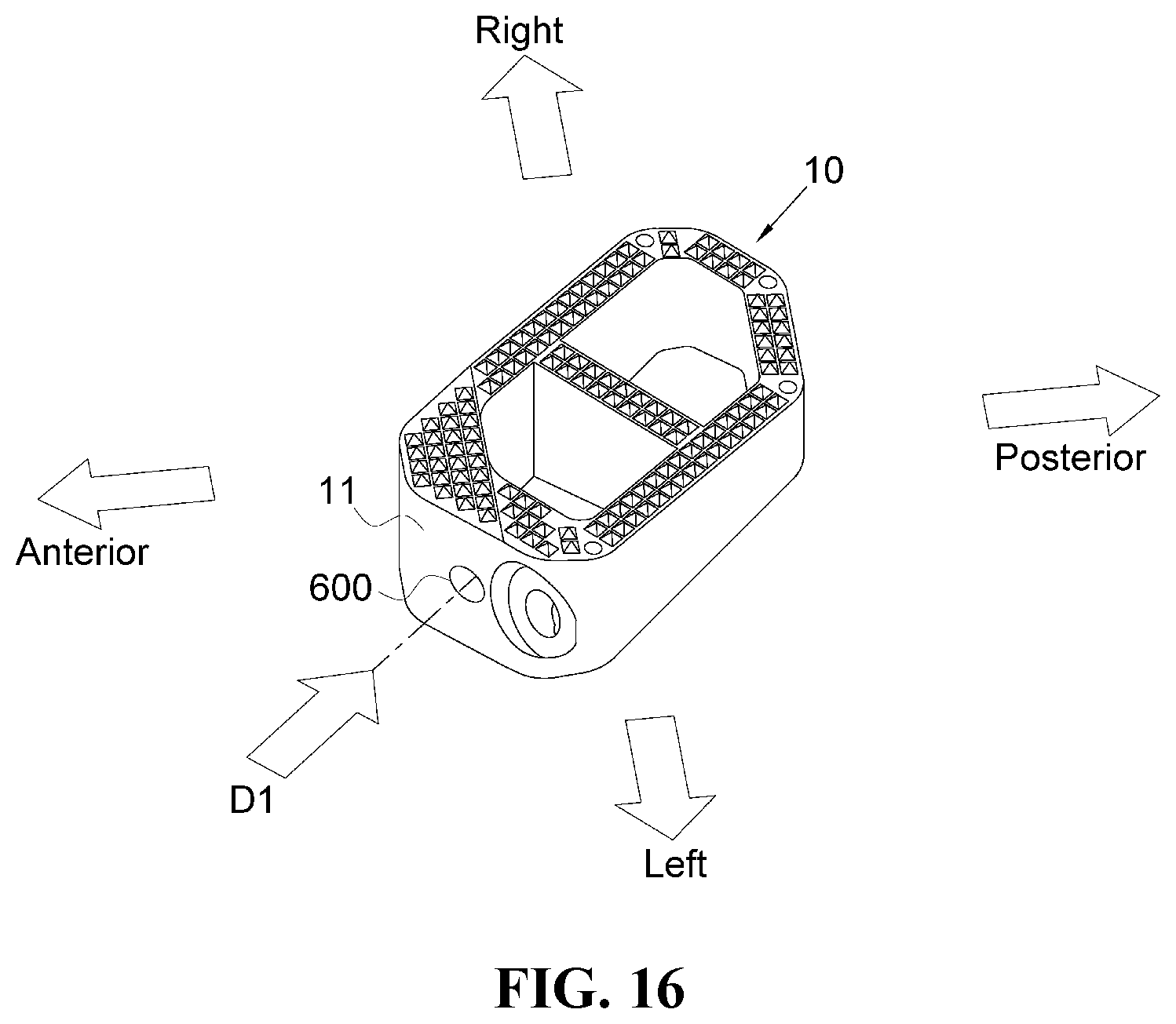 Patent US12472076 Figure 15 – Oblique lateral insertion-type intervertebral cage