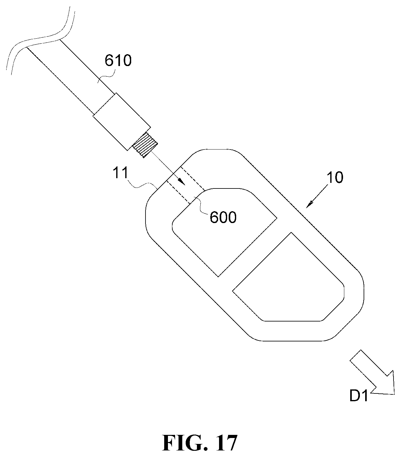 Patent US12472076 Figure 16 – Oblique lateral insertion-type intervertebral cage