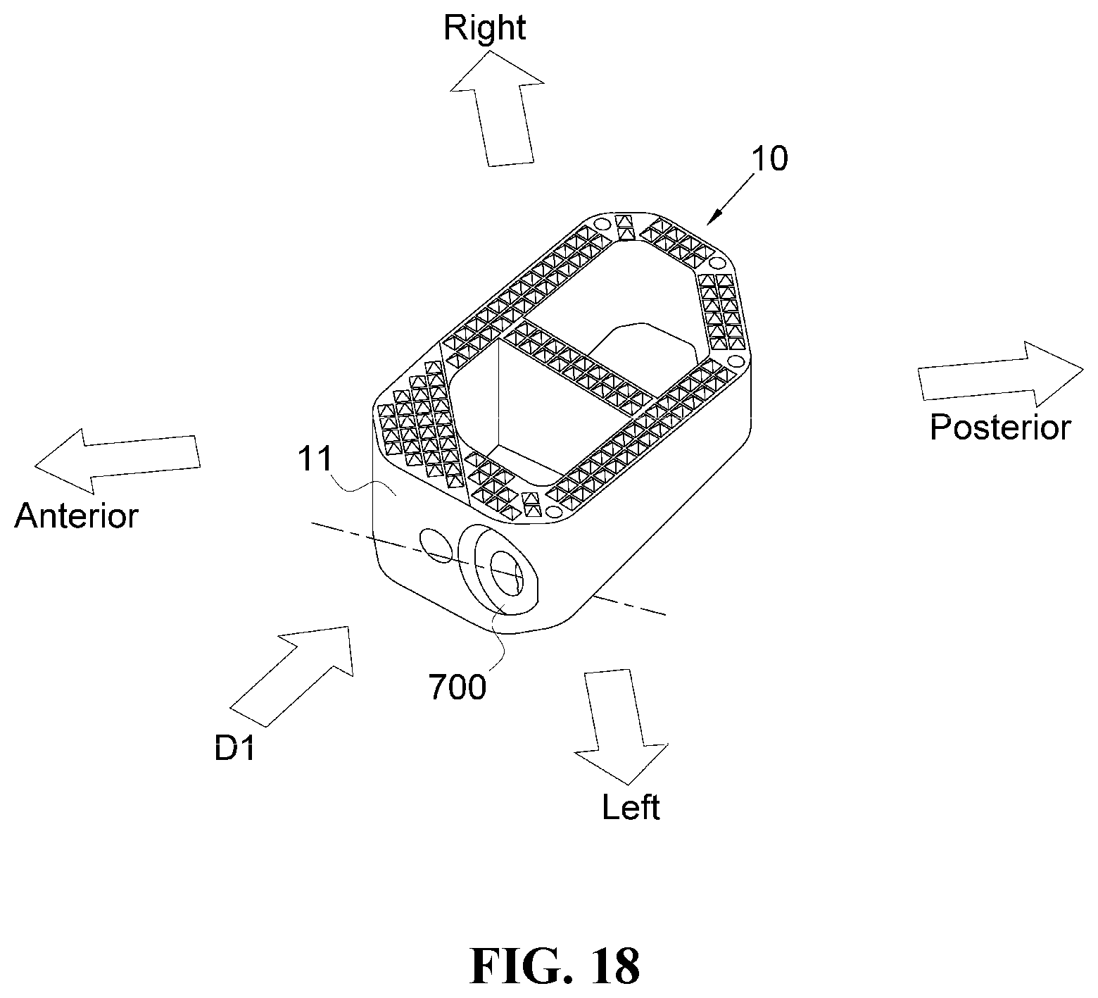 Patent US12472076 Figure 17 – Oblique lateral insertion-type intervertebral cage