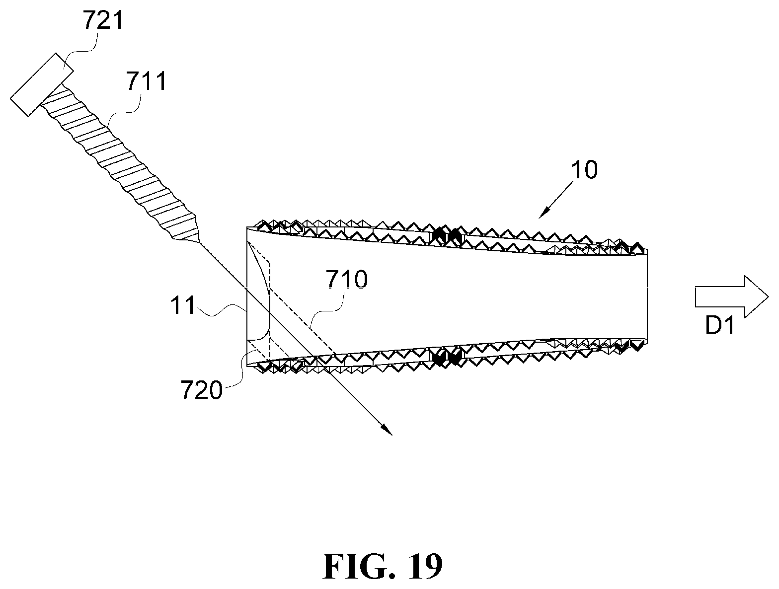 Patent US12472076 Figure 18 – Oblique lateral insertion-type intervertebral cage