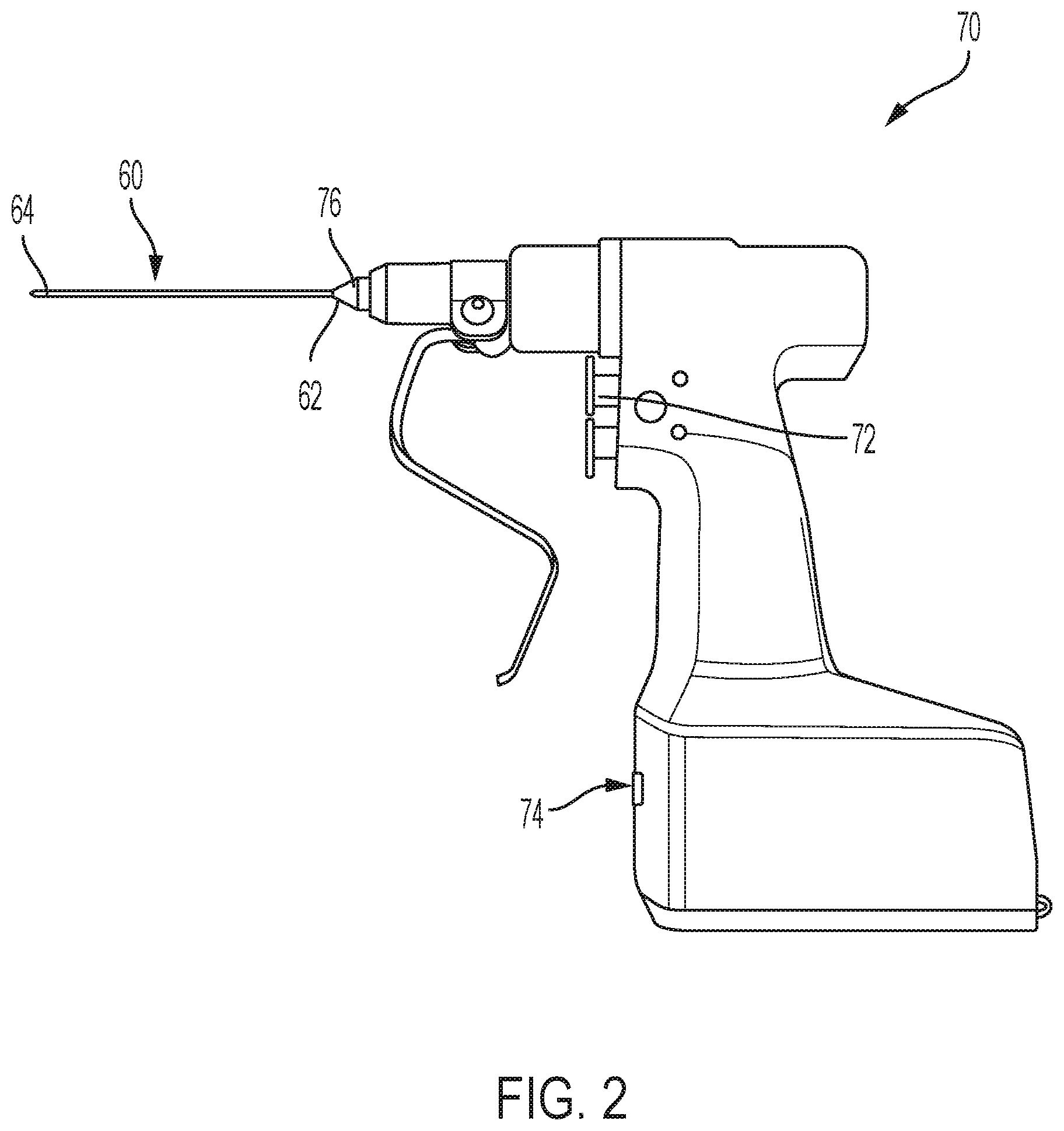 Patent US12472078 Figure 2 – Intramedullary prosthesis removal systems and methods thereof
