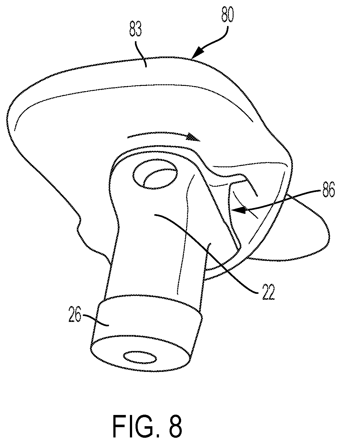Patent US12472078 Figure 6 – Intramedullary prosthesis removal systems and methods thereof