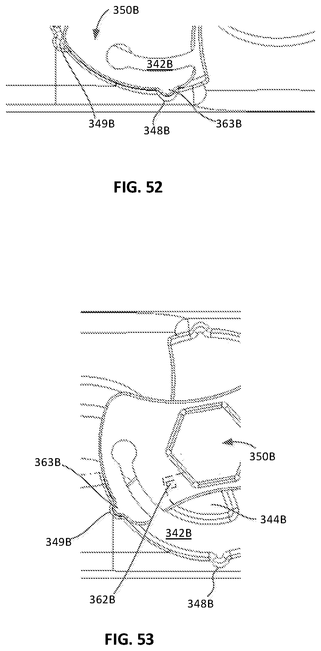 Patent US12472079 Figure 18 – Interbody implants and instrumentation