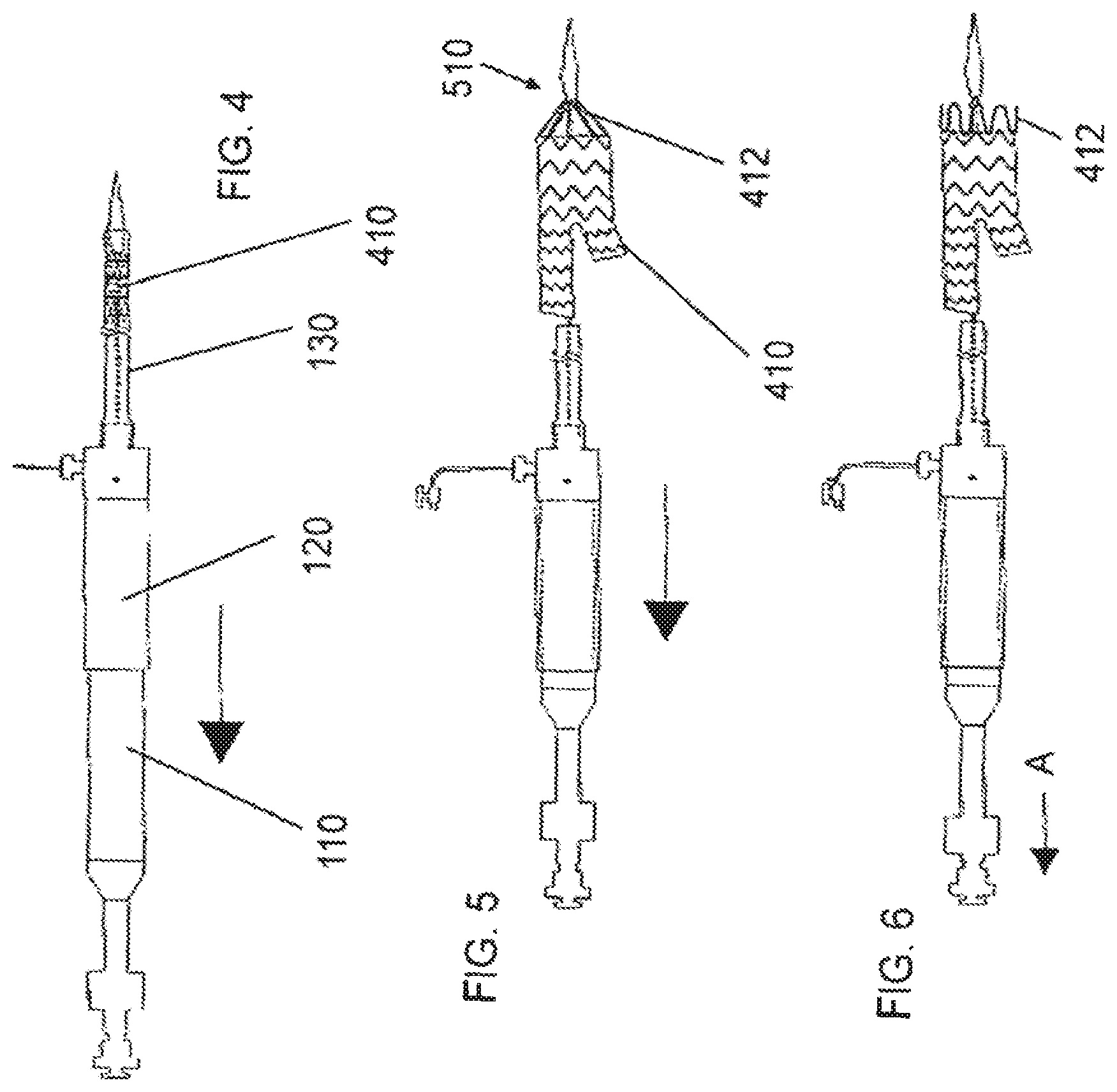 Patent US12472081 Figure 2 – Abdominal aortic aneurysms: systems and methods of use
