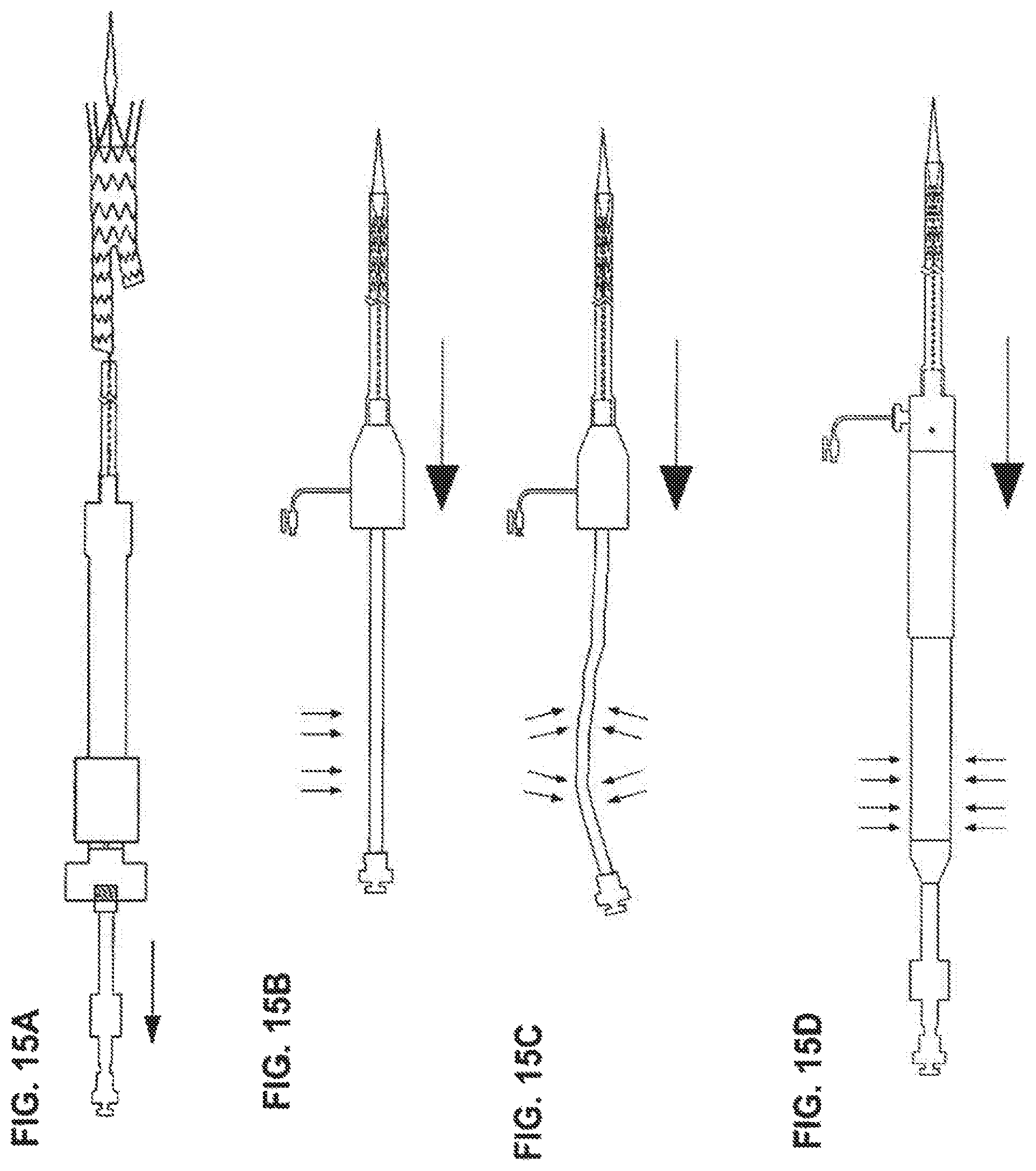 Patent US12472081 Figure 5 – Abdominal aortic aneurysms: systems and methods of use
