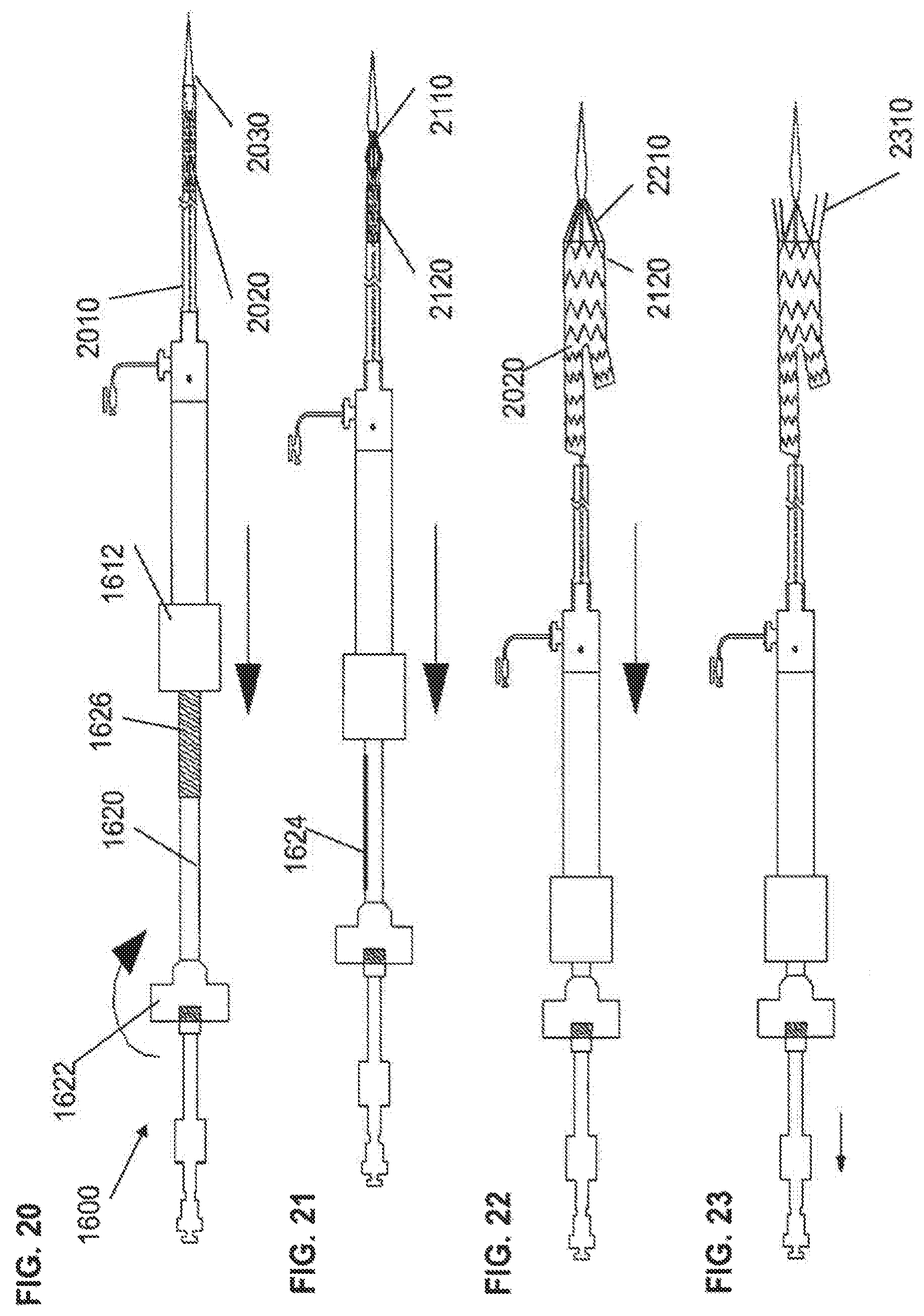 Patent US12472081 Figure 7 – Abdominal aortic aneurysms: systems and methods of use
