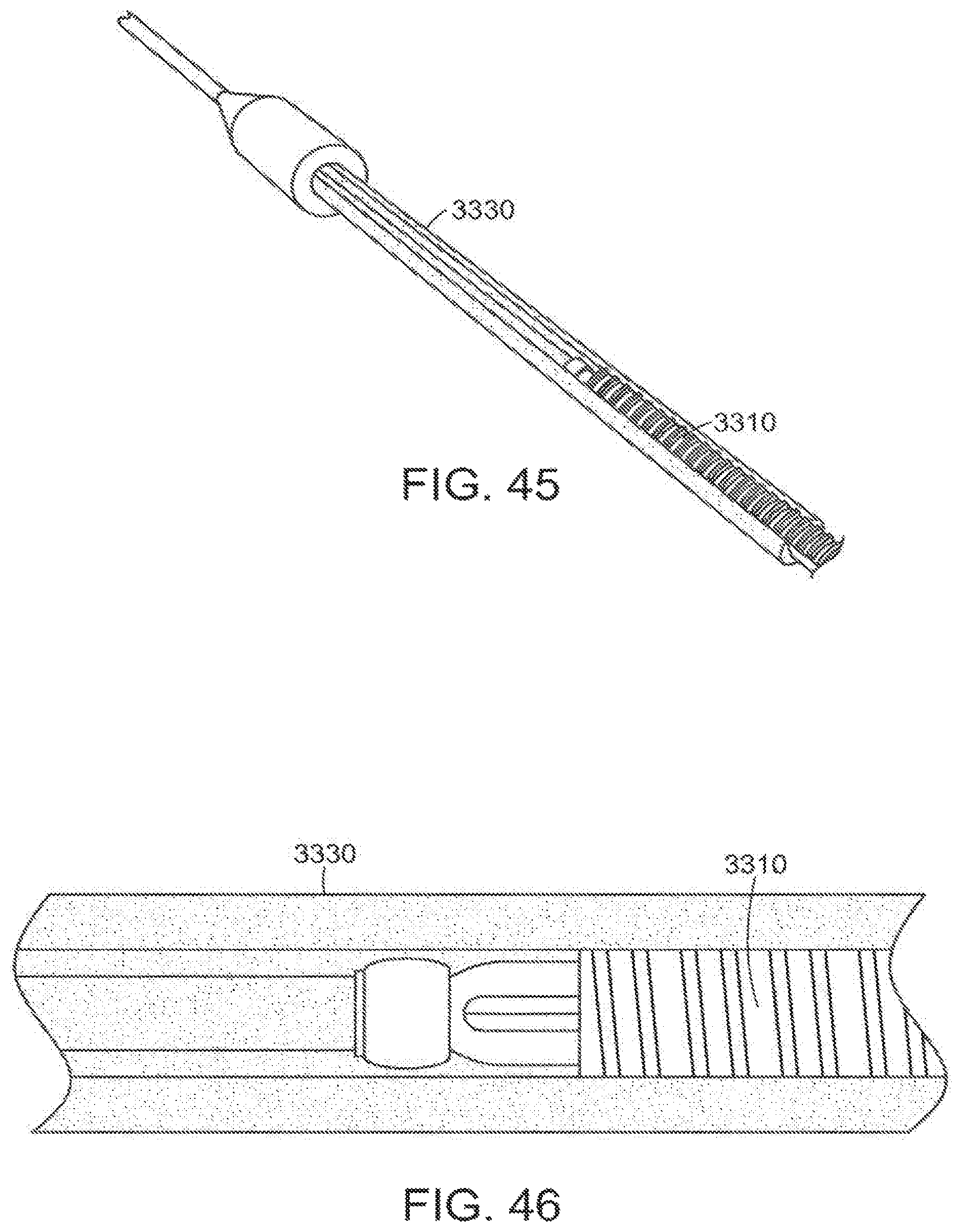 Patent US12472081 Figure 17 – Abdominal aortic aneurysms: systems and methods of use