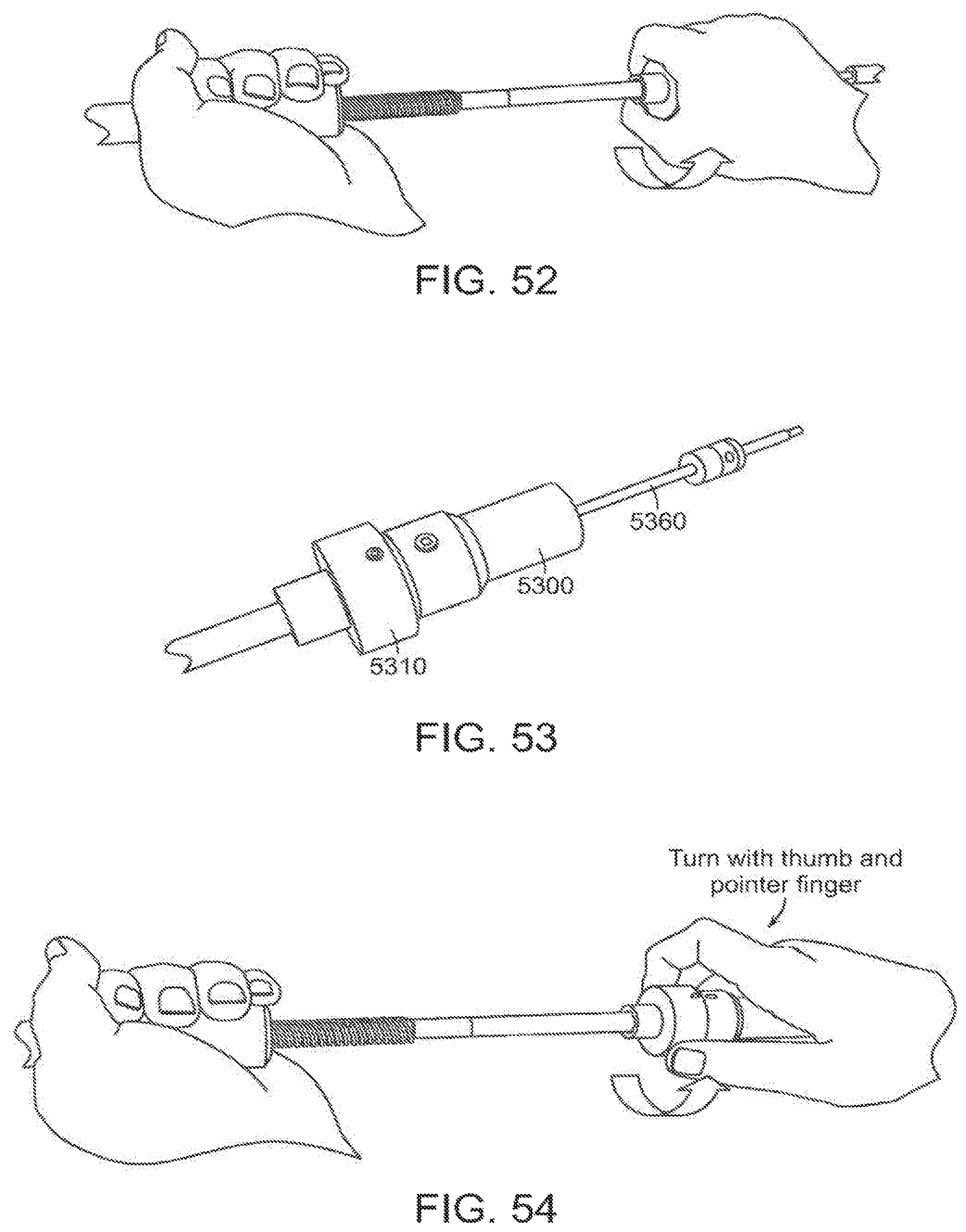 Patent US12472081 Figure 20 – Abdominal aortic aneurysms: systems and methods of use