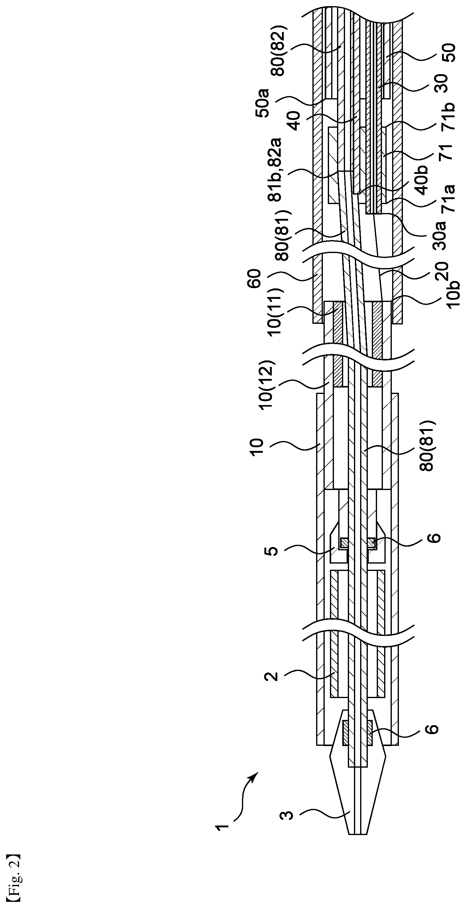 Patent US12472082 Figure 2 – Medical tubular body delivery device and method for manufacturing the same
