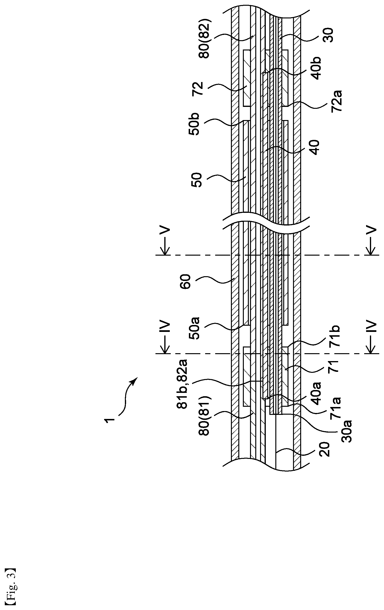 Patent US12472082 Figure 3 – Medical tubular body delivery device and method for manufacturing the same