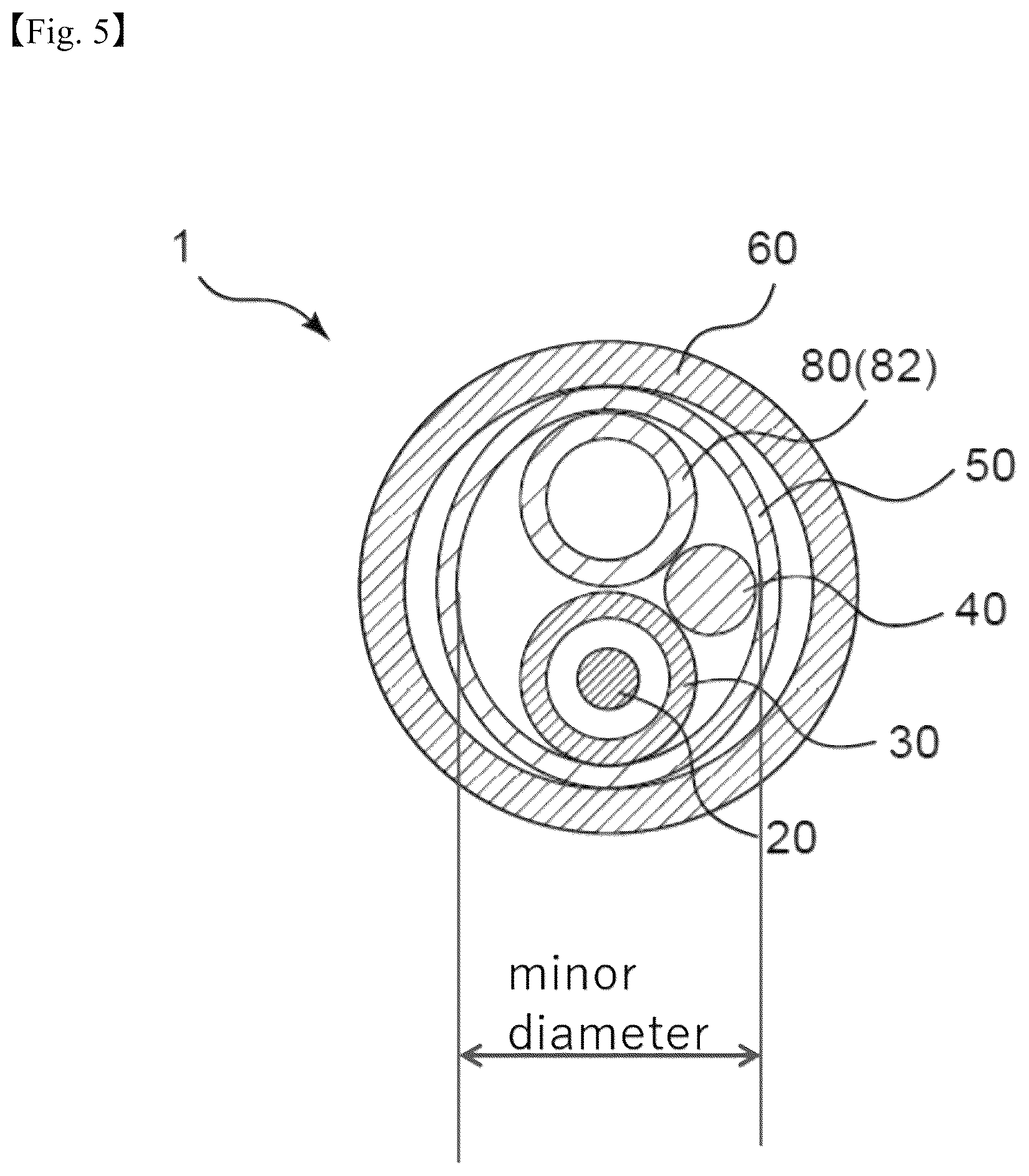 Patent US12472082 Figure 5 – Medical tubular body delivery device and method for manufacturing the same