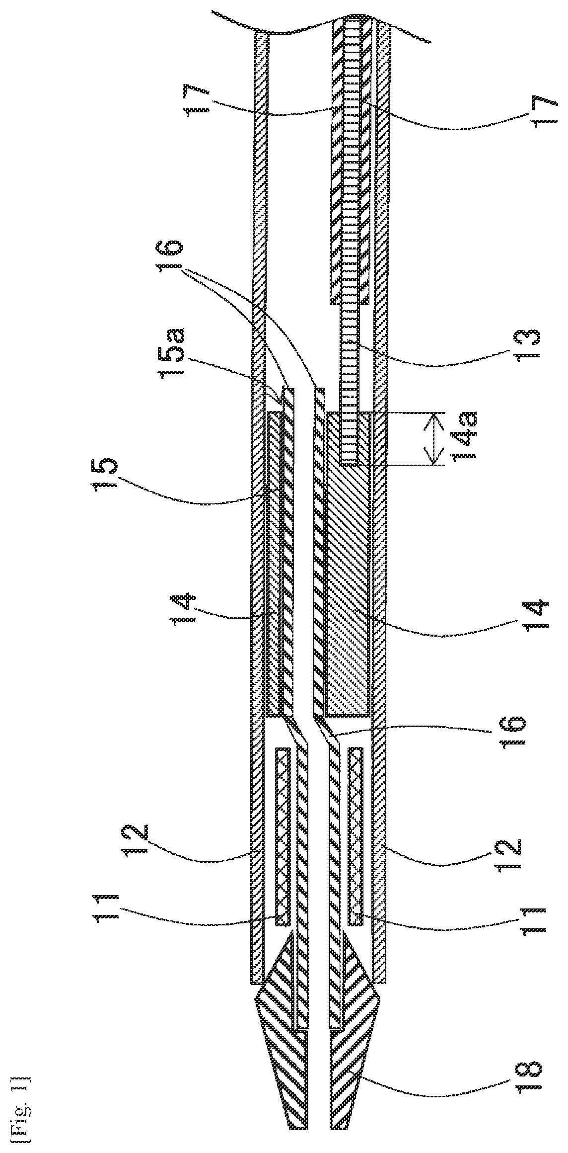 Patent US12472083 Figure 1 – Medical tubular body delivering device