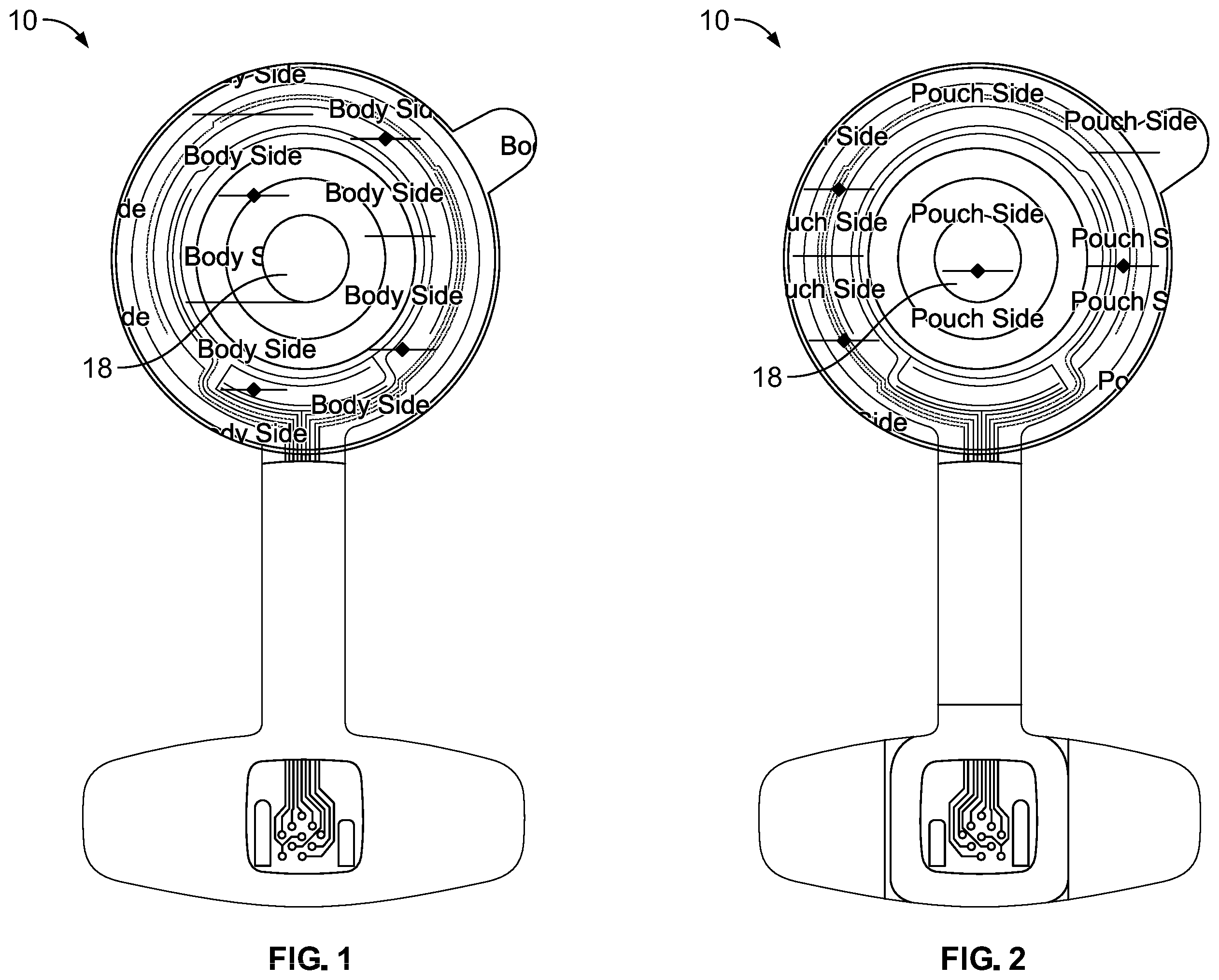 Patent US12472085 Figure 1 – Double-sided sensor device for ostomy leak detection system