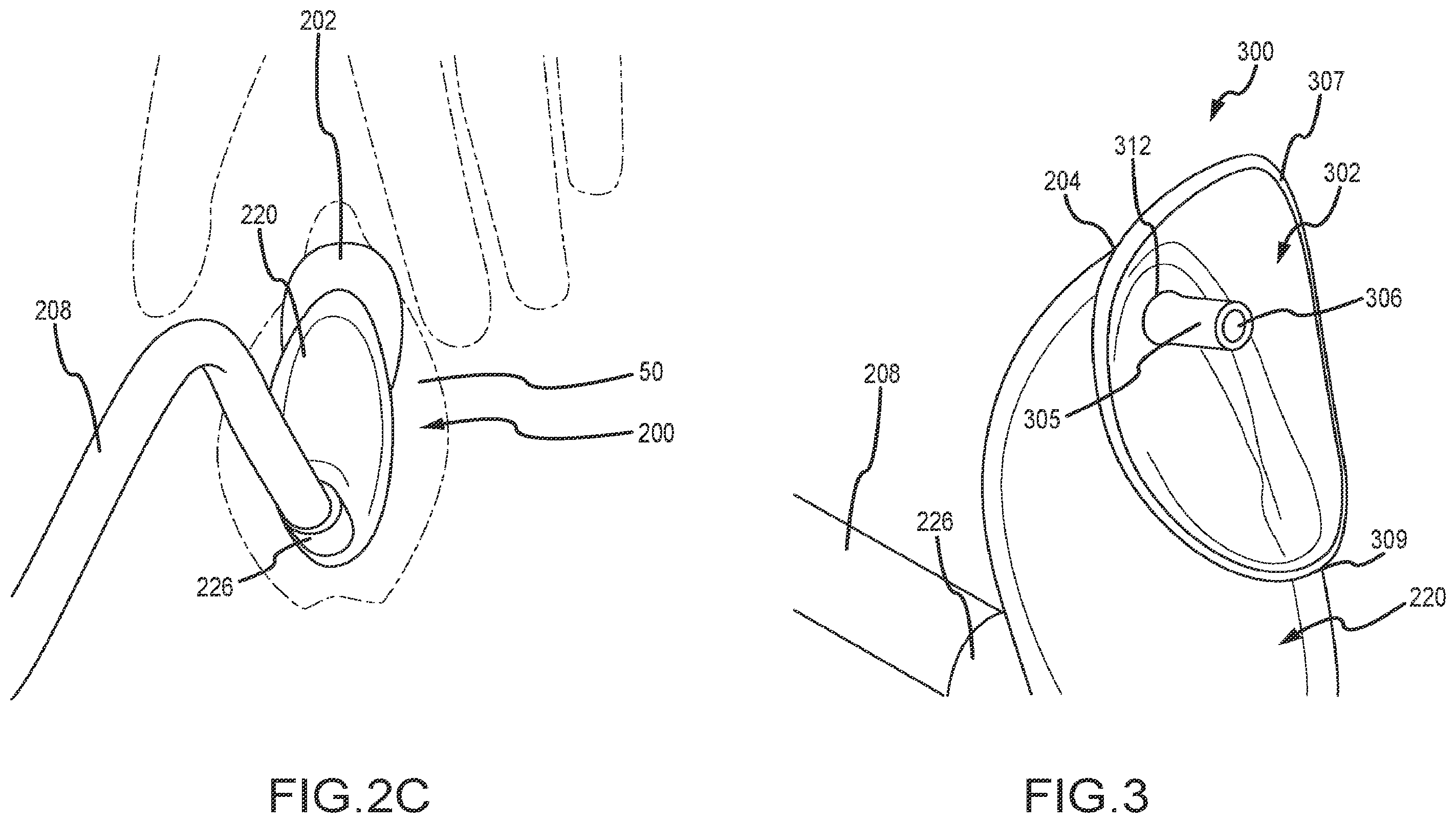 Patent US12472090 Figure 3 – Female external catheter devices having a urethral cup, and related systems and methods