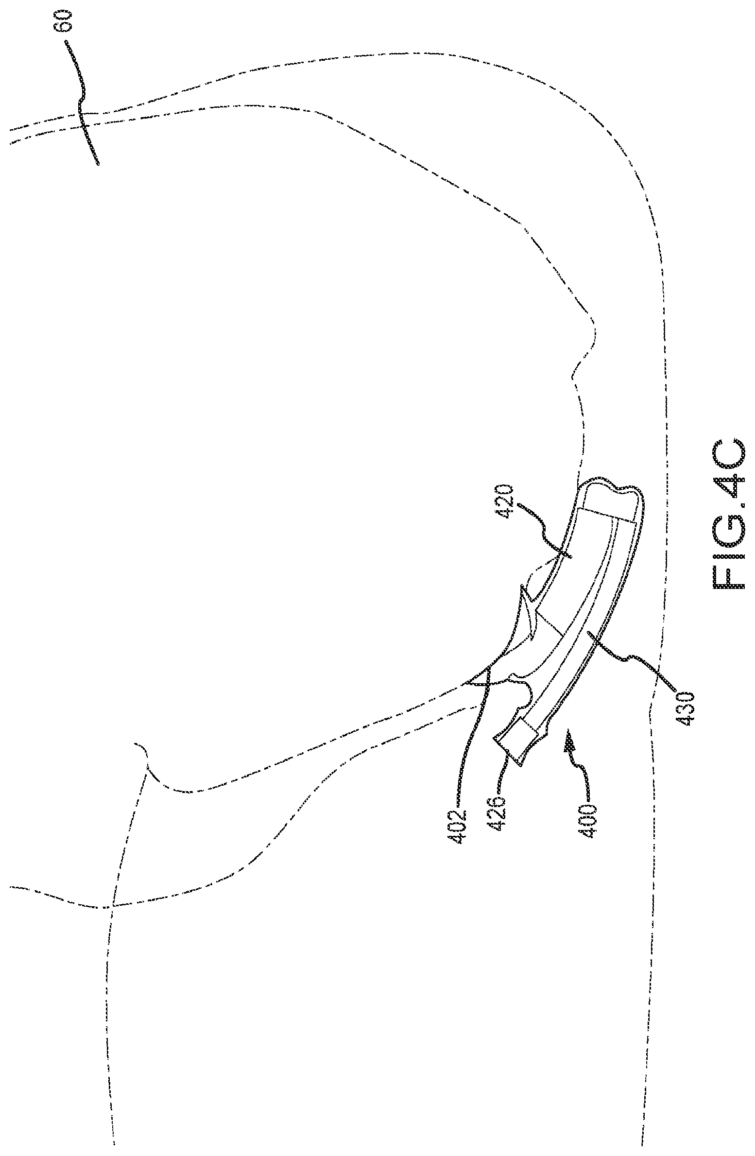 Patent US12472090 Figure 5 – Female external catheter devices having a urethral cup, and related systems and methods