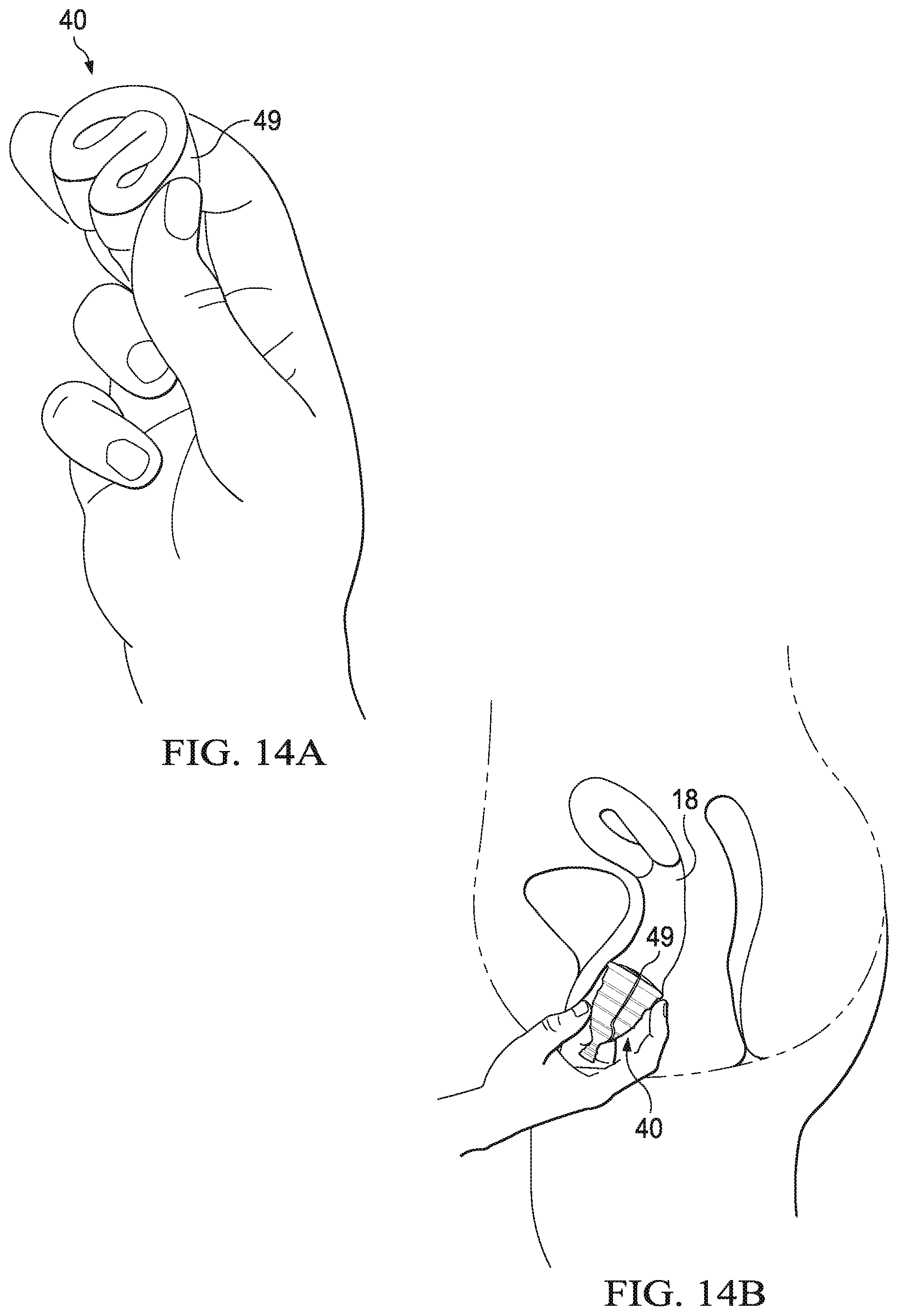 Patent US12472092 Figure 15 – Flexible cone-shaped intra-vaginal support device