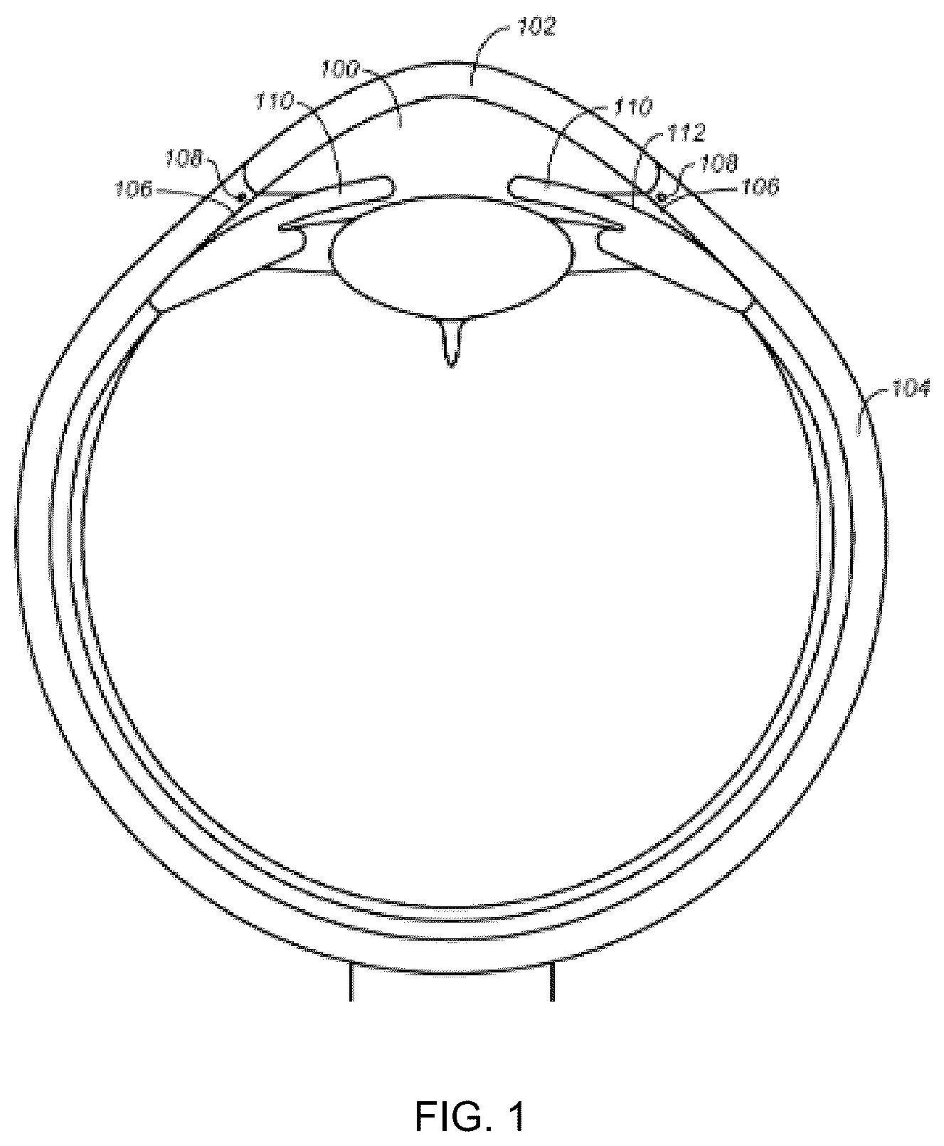 Patent US12472099 Figure 1 – Medical device and ocular implant for treatment of ocular disorders