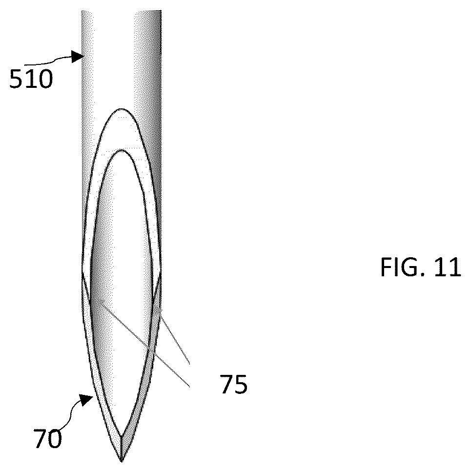 Patent US12472099 Figure 13 – Medical device and ocular implant for treatment of ocular disorders