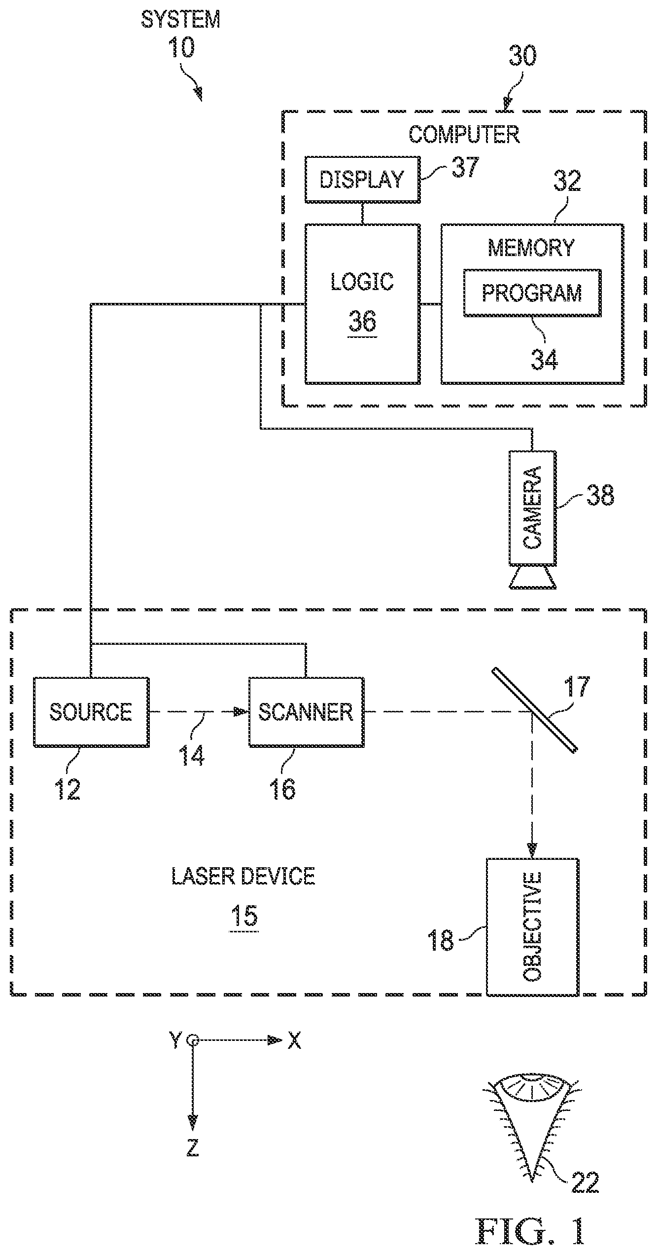 Patent US12472100 — Managing laser shot frequency for an ophthalmic surgical system — Figure 1