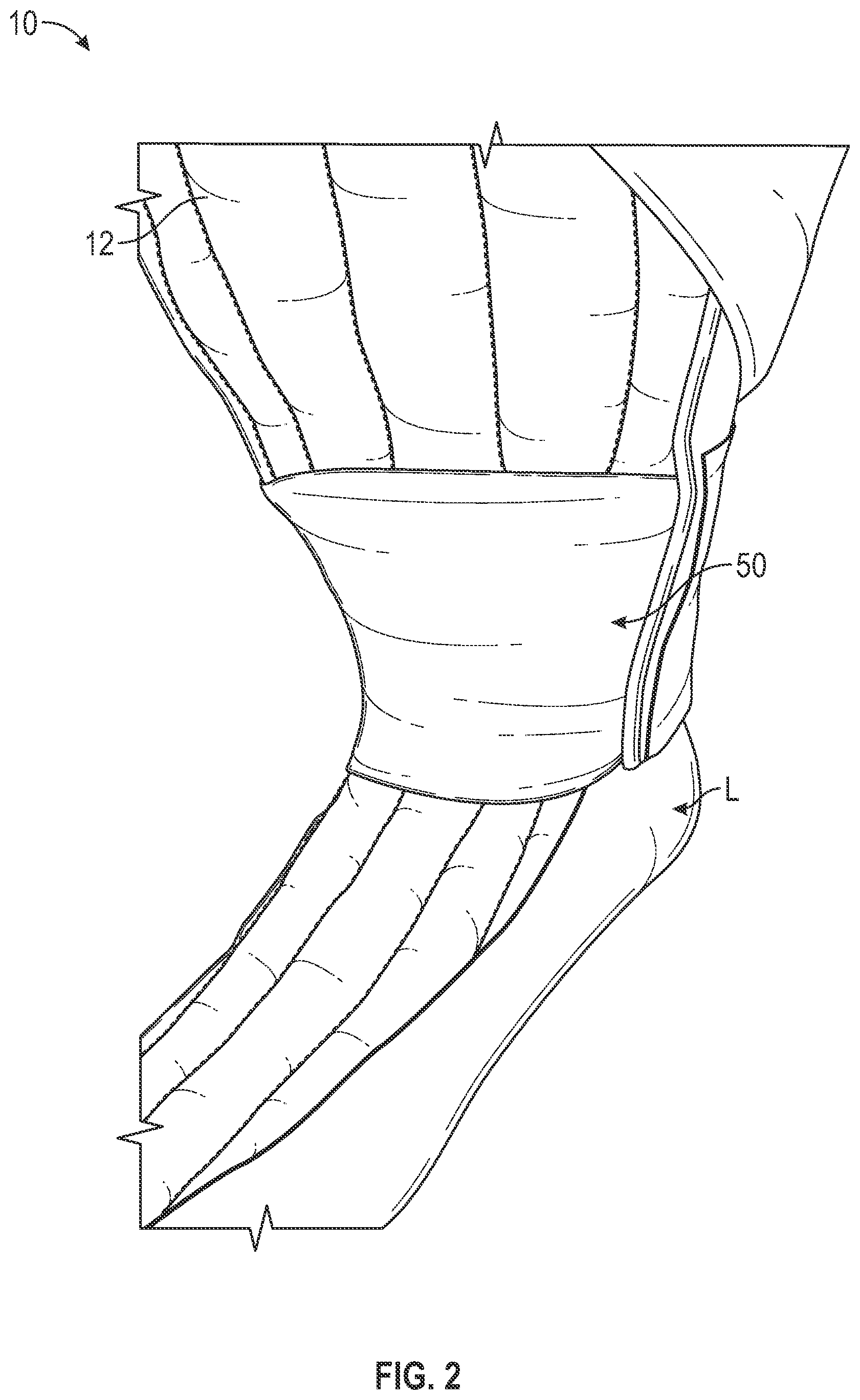 Patent US12472105 Figure 2 – Foam sleeve garment with easy access feature