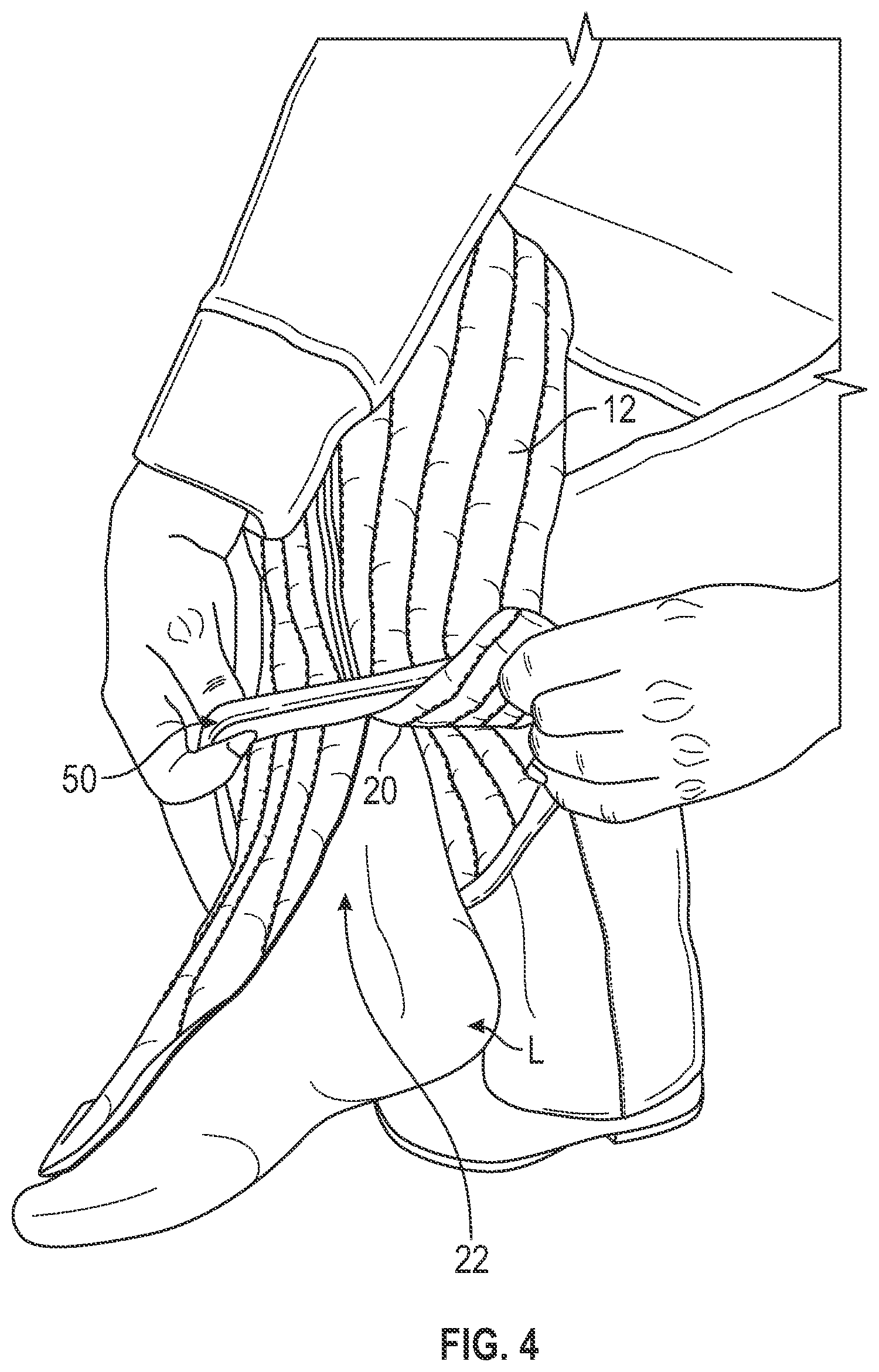 Patent US12472105 Figure 4 – Foam sleeve garment with easy access feature