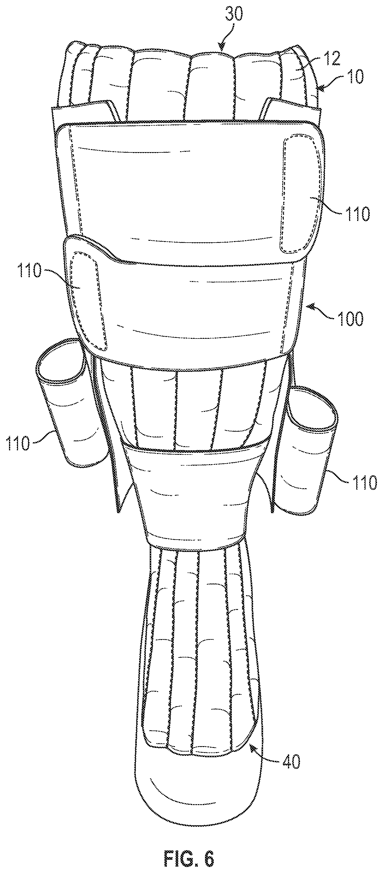 Patent US12472105 Figure 6 – Foam sleeve garment with easy access feature
