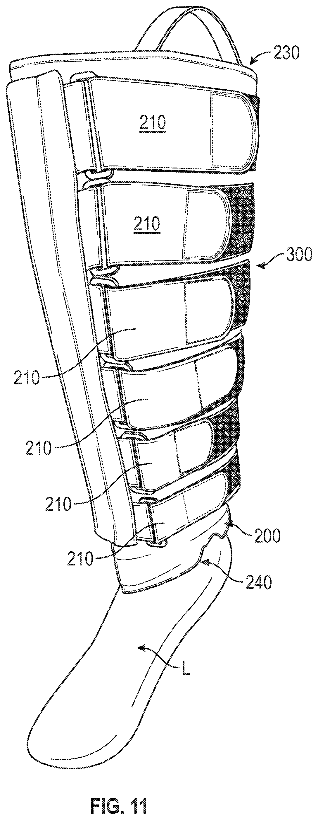 Patent US12472105 Figure 11 – Foam sleeve garment with easy access feature