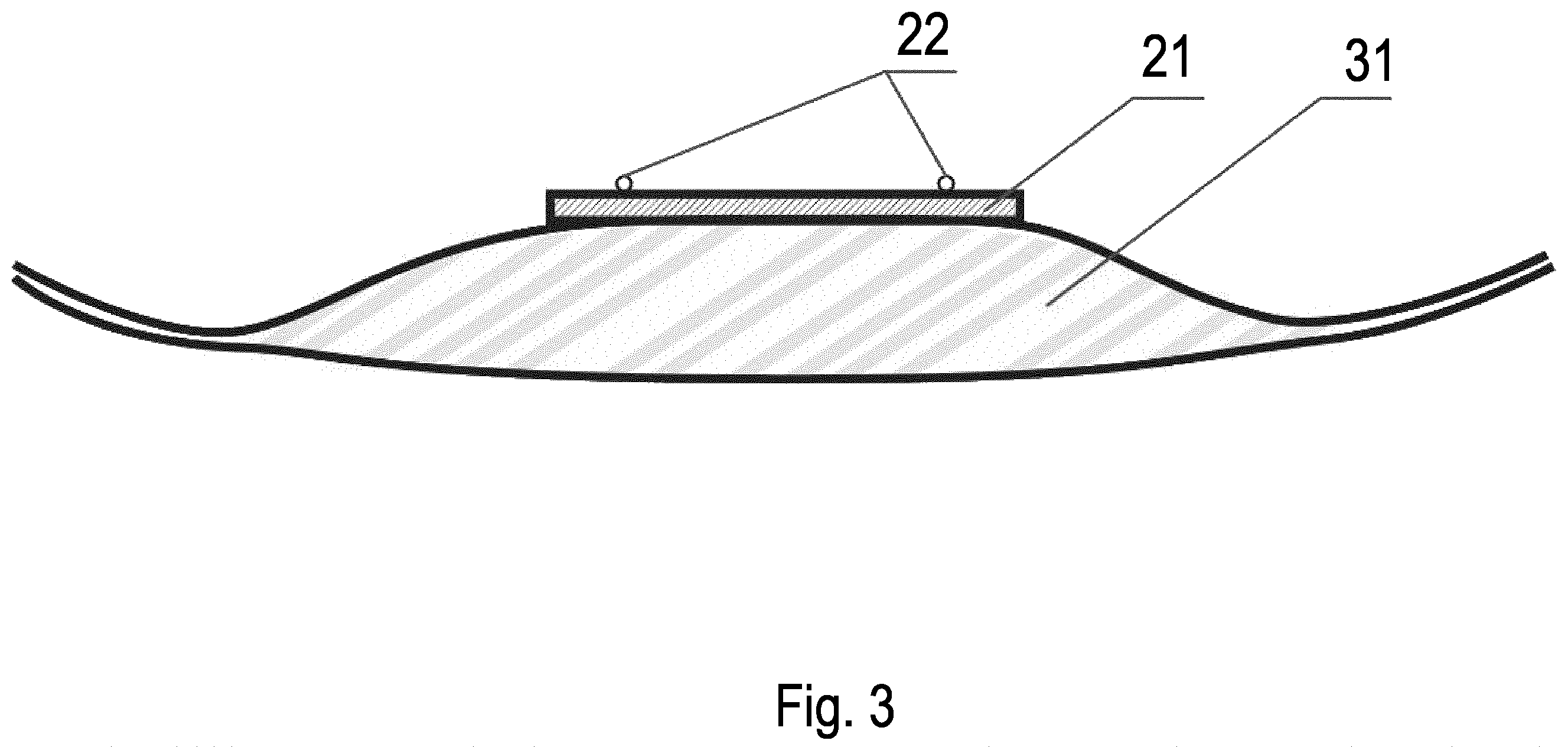 Patent US12472107 Figure 3 – Detecting device for detecting a state of a diaper, diaper accommodating the detecting device