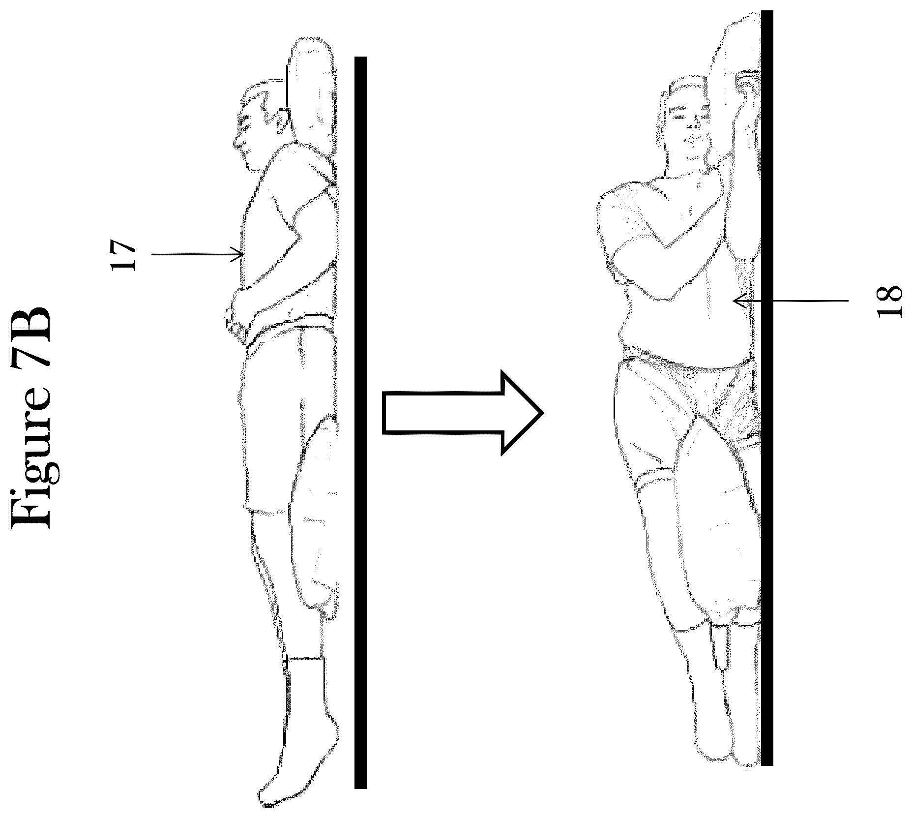 Patent US12472108 Figure 17 – Incontinence detection system