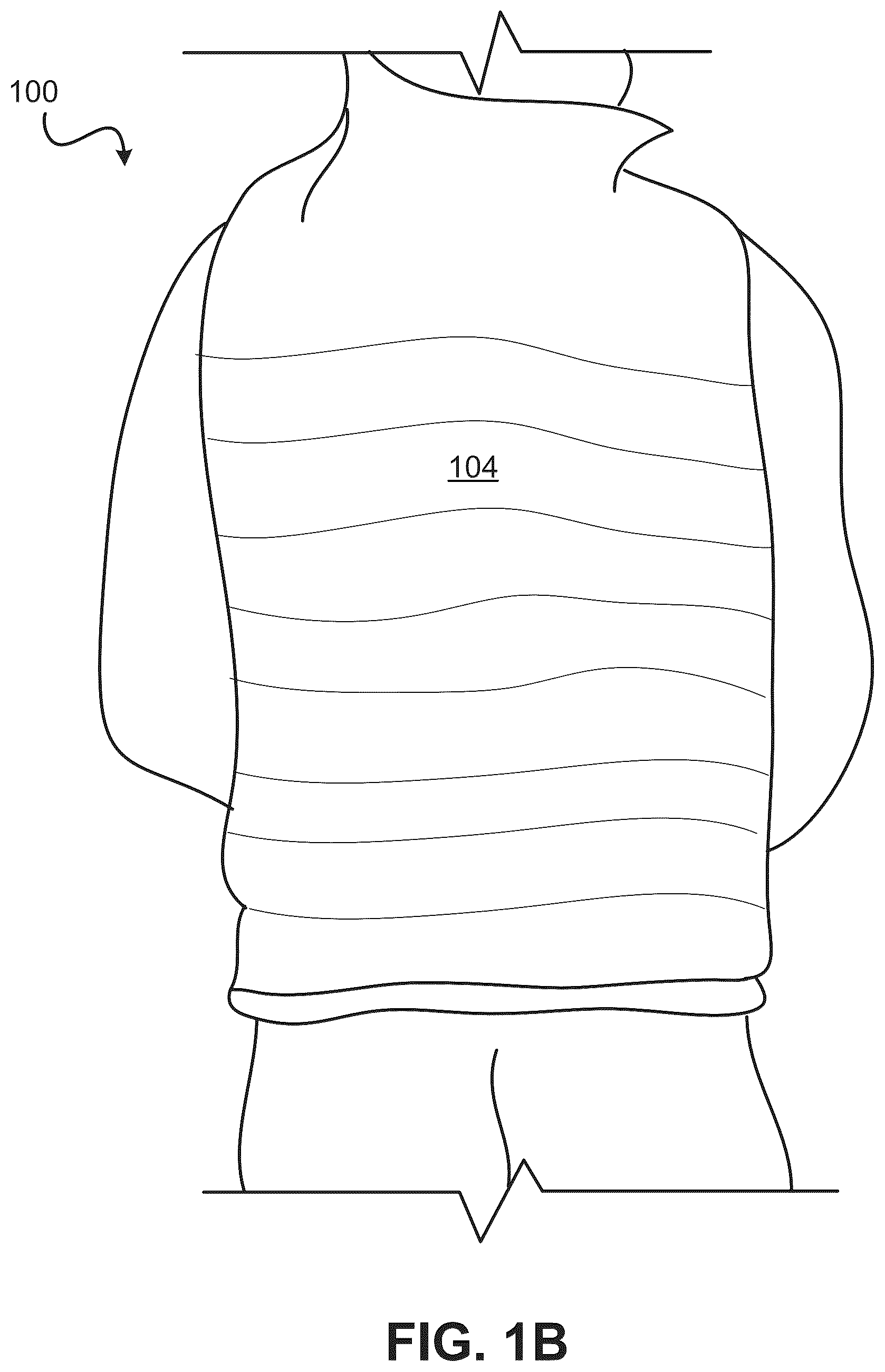 Patent US12472120 Figure 2 – Inflation-mediated pressure therapy garment