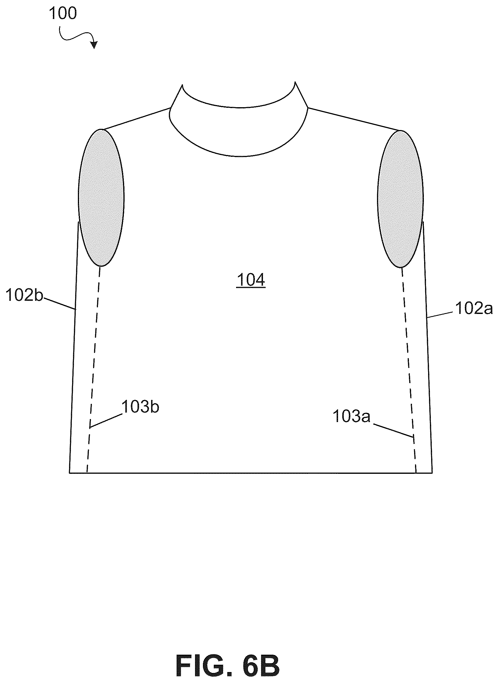 Patent US12472120 Figure 10 – Inflation-mediated pressure therapy garment
