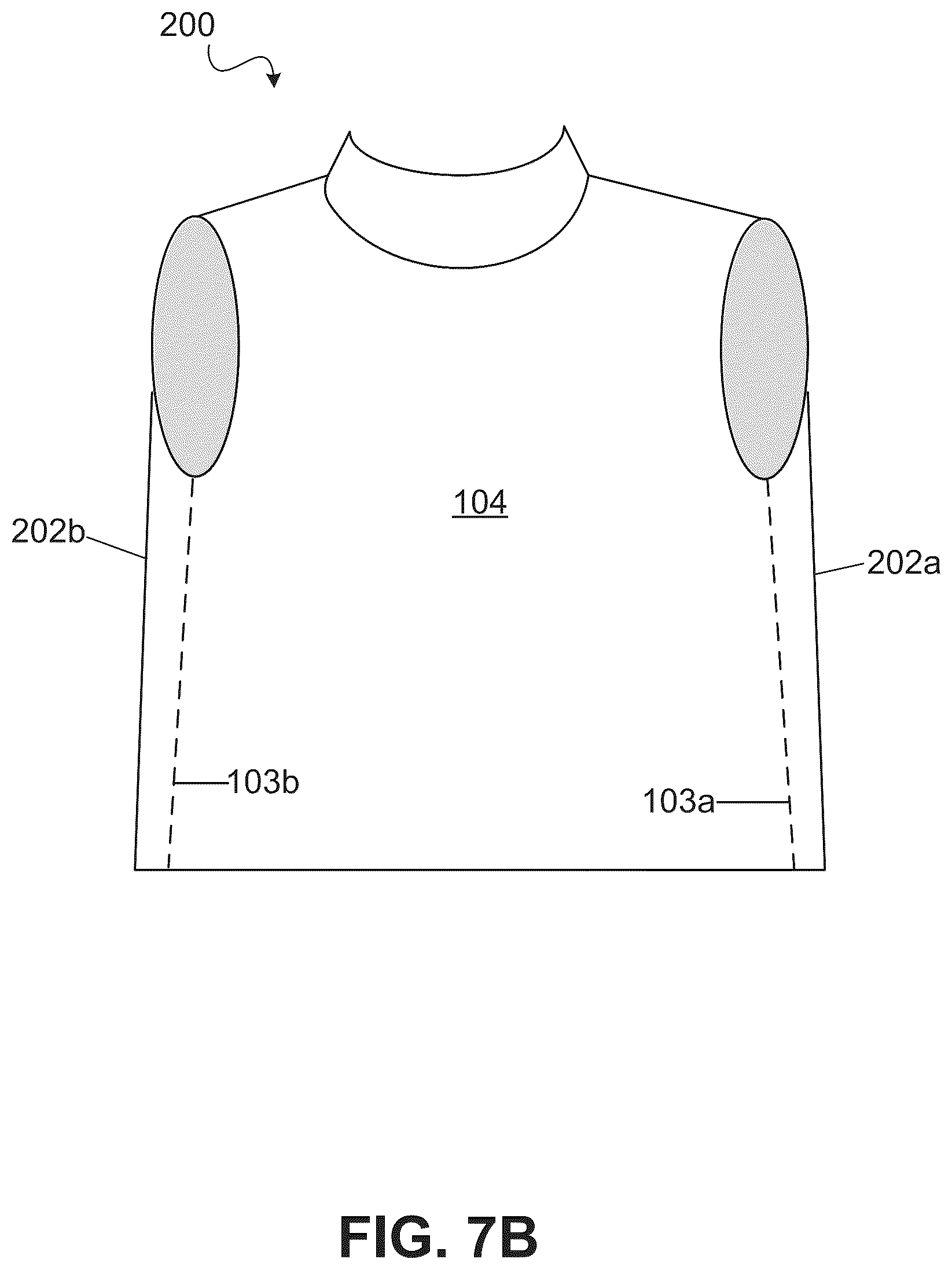Patent US12472120 Figure 12 – Inflation-mediated pressure therapy garment