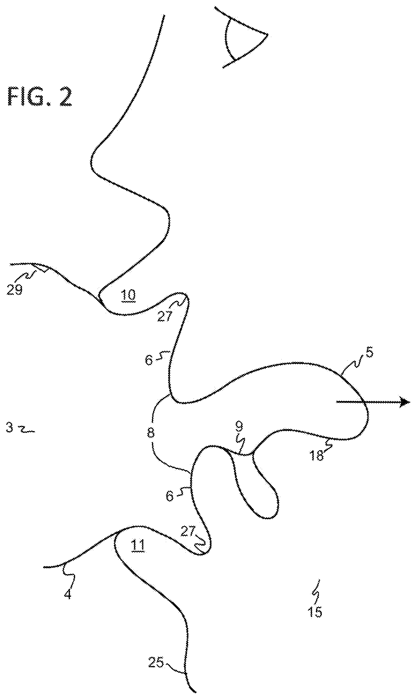 Patent US12472126 Figure 2 – Orthotropic and orthognathic oral device and method