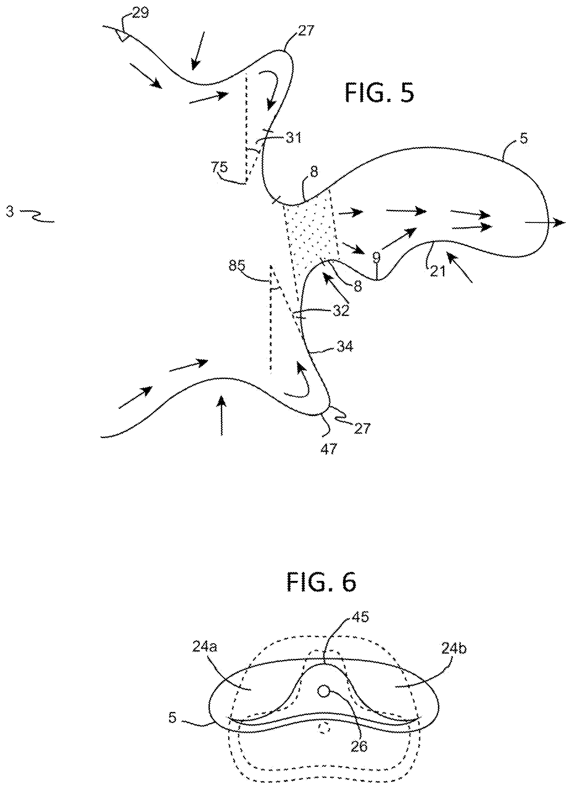 Patent US12472126 Figure 4 – Orthotropic and orthognathic oral device and method