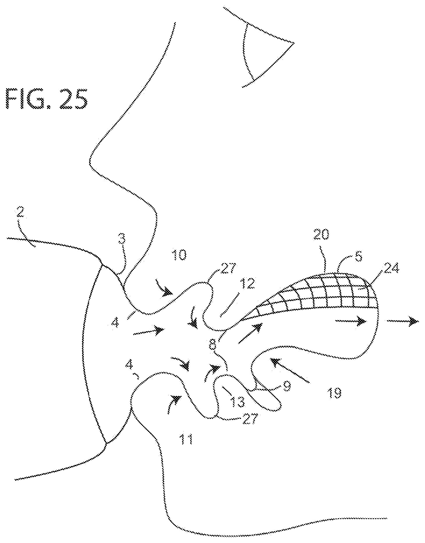Patent US12472126 Figure 12 – Orthotropic and orthognathic oral device and method