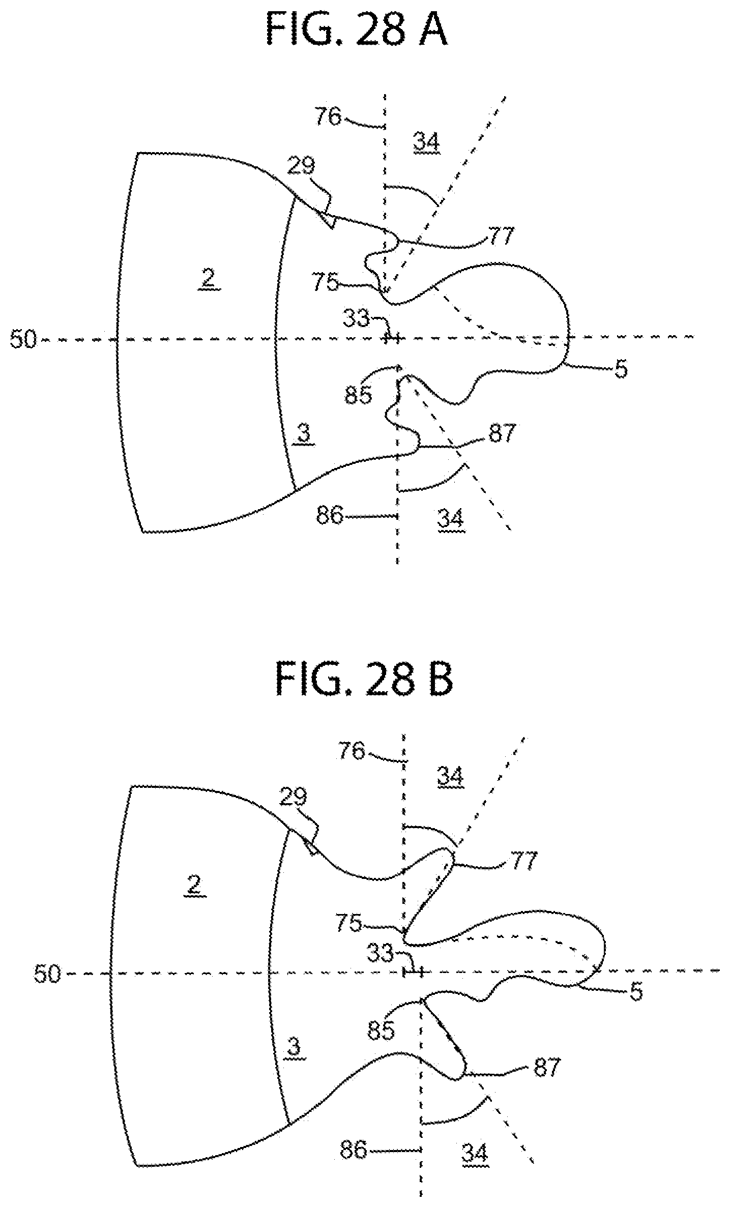 Patent US12472126 Figure 14 – Orthotropic and orthognathic oral device and method