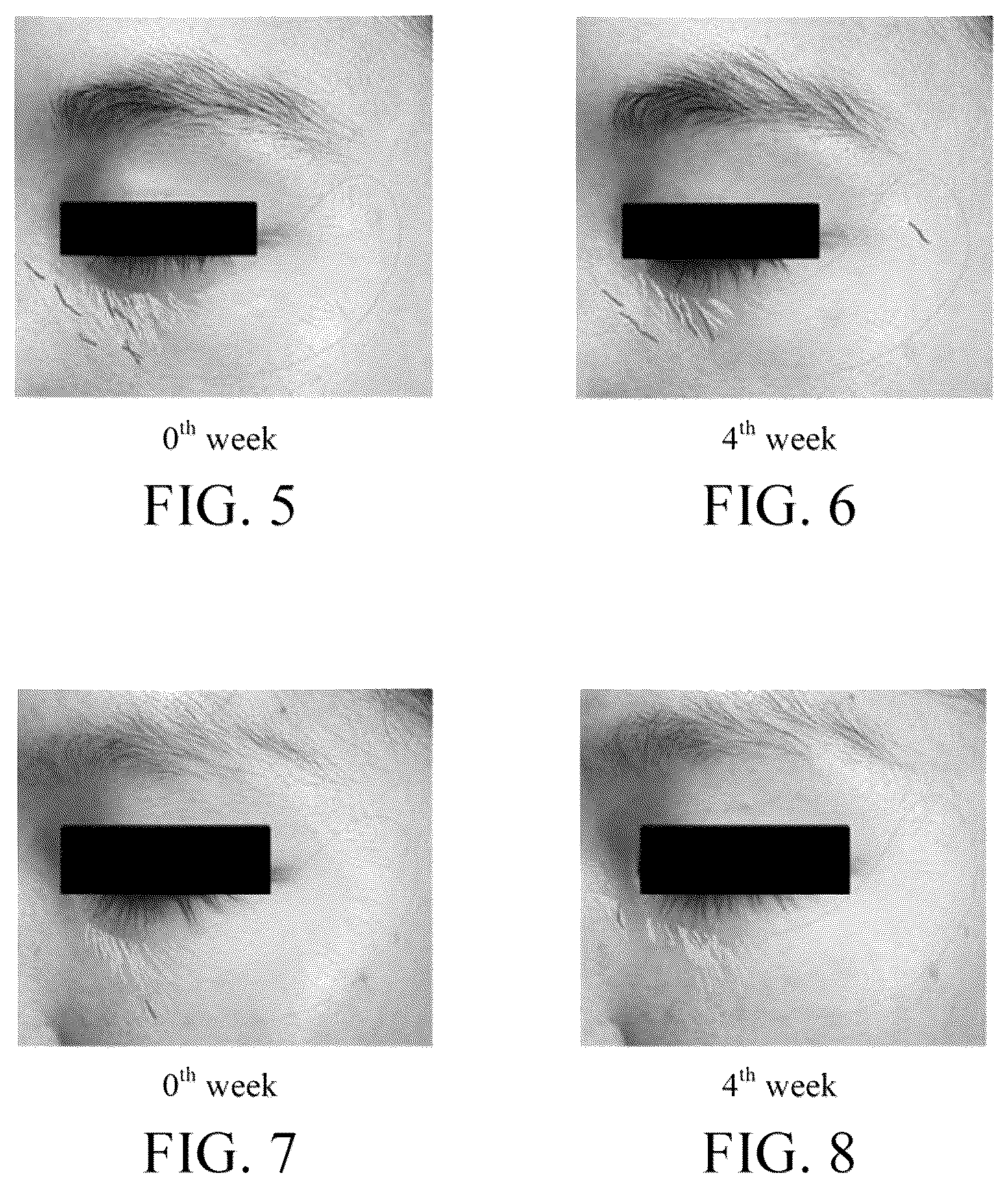 Patent US12472139 Figure 4 – Method for maintaining skin corneum layer completeness, promoting hyaluronic acid production, improving skin cell mitochondrion activity and/ or promoting skin cell proliferation by using bacterial lysate of Halobacillus trueperi TCI66207
