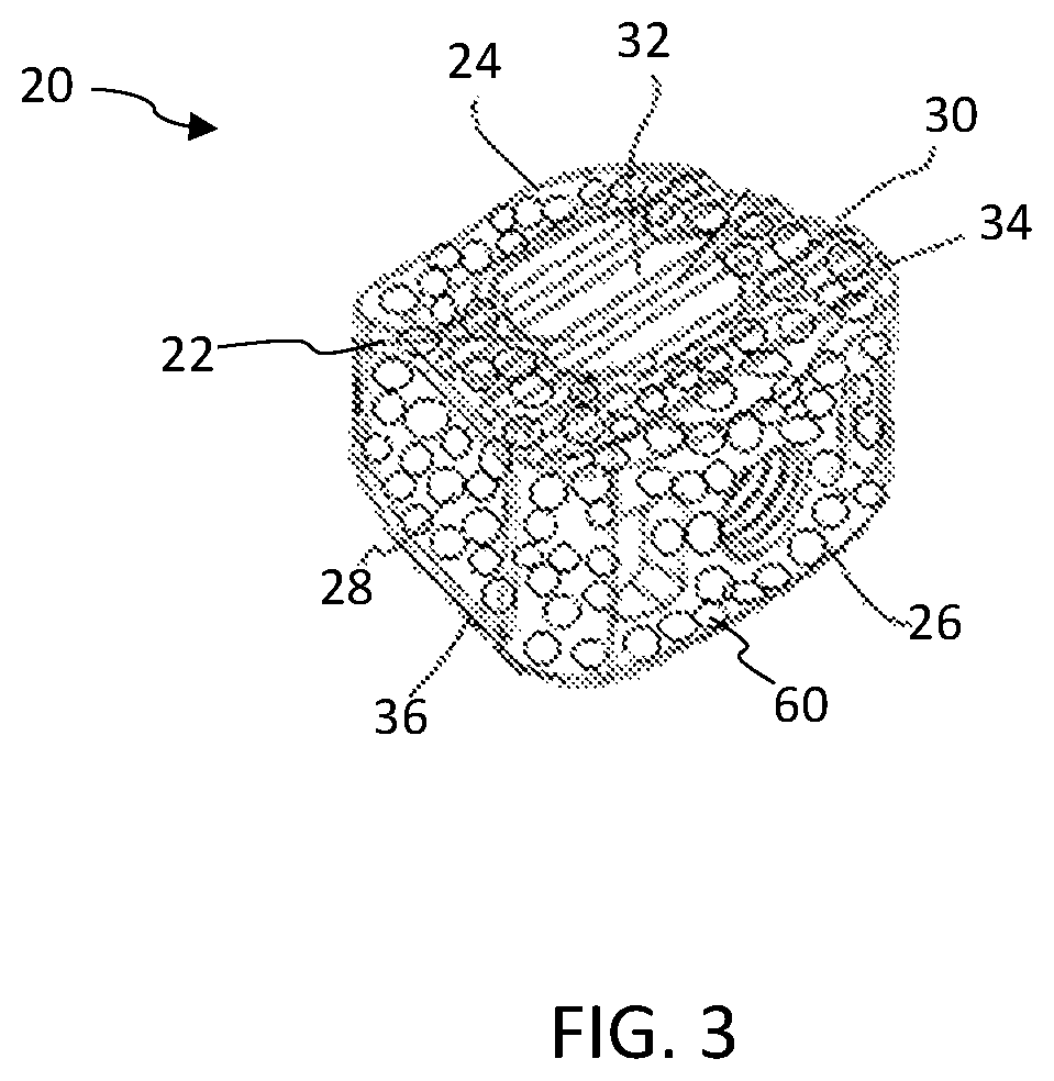 Patent US12472141 Figure 3 – Drug delivery for intervertebral disc pain management