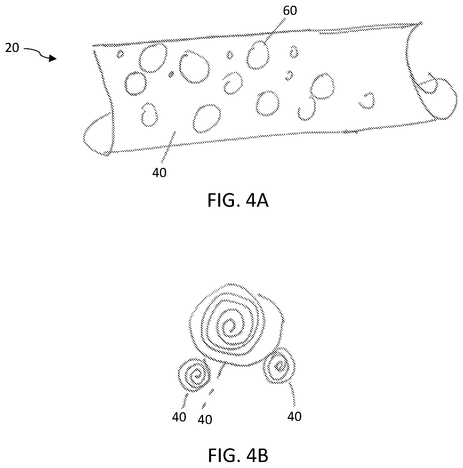 Patent US12472141 Figure 4 – Drug delivery for intervertebral disc pain management