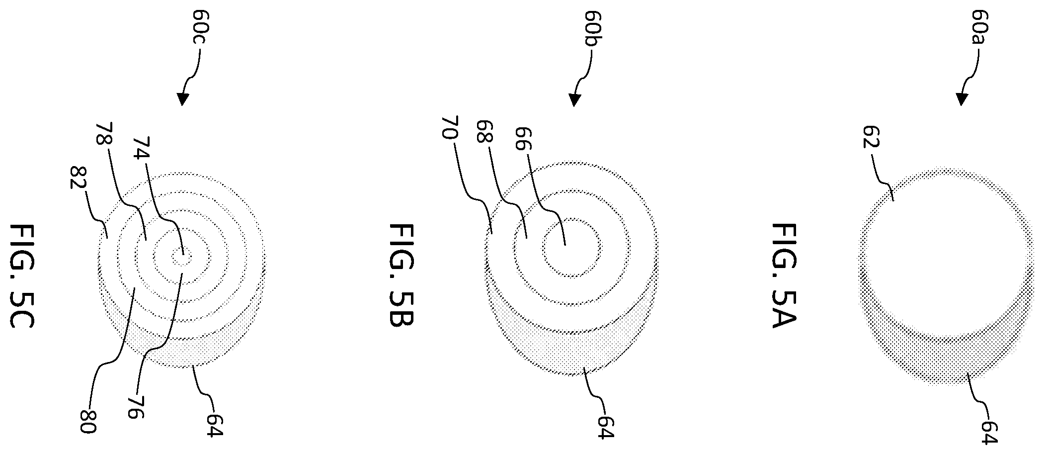 Patent US12472141 Figure 5 – Drug delivery for intervertebral disc pain management